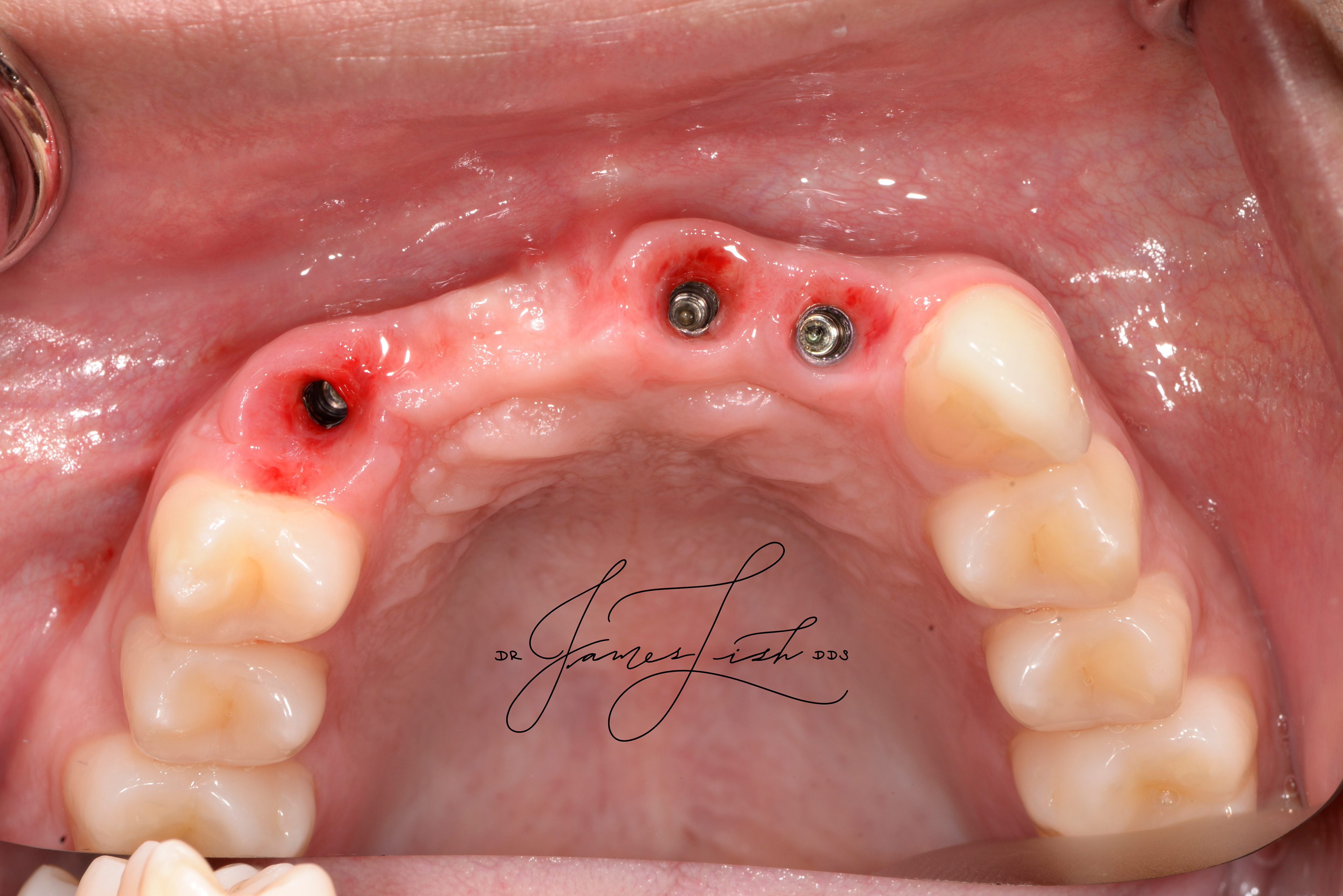 Top view of healthy tissues