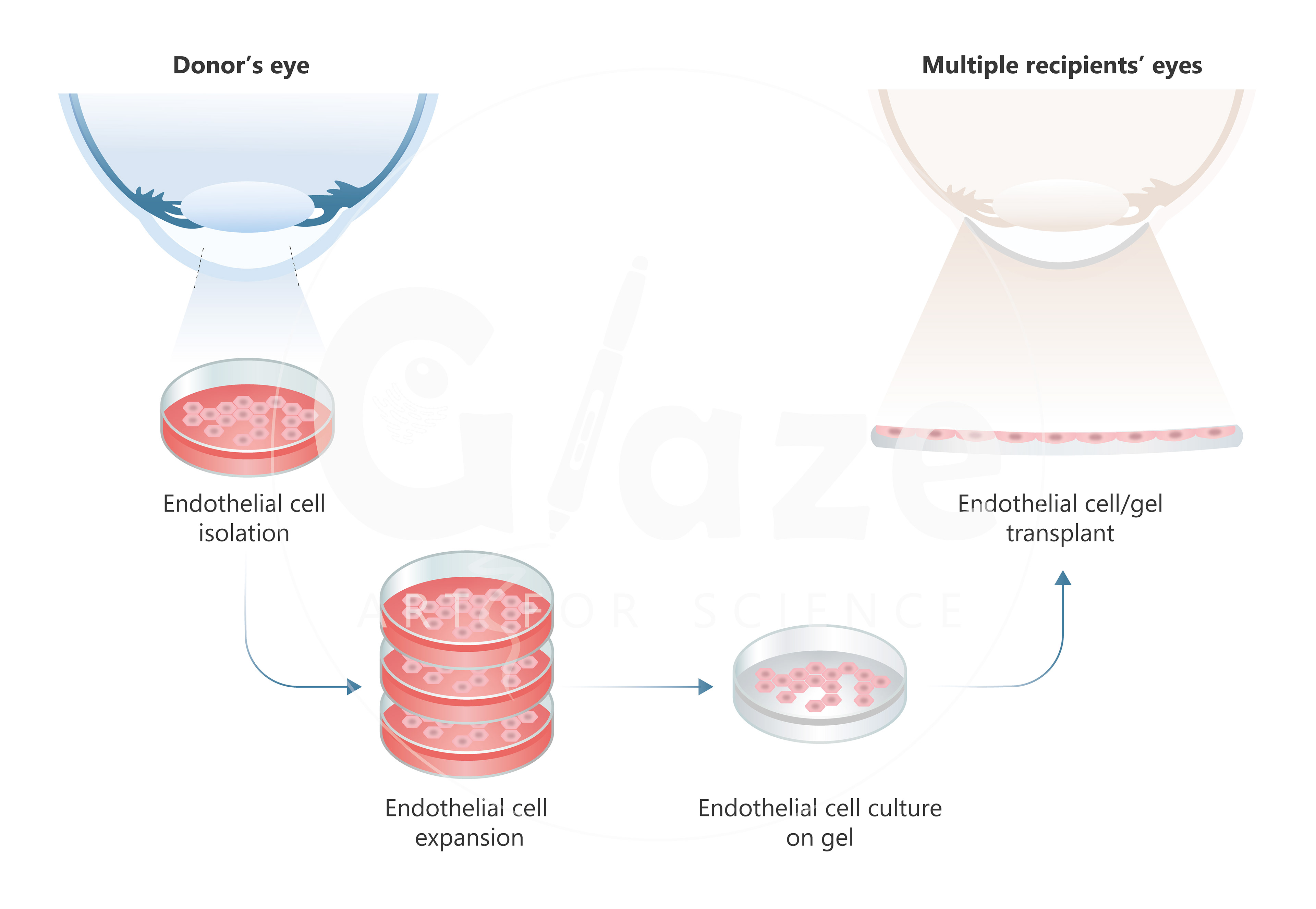 Corneal cell transplant (U flow)