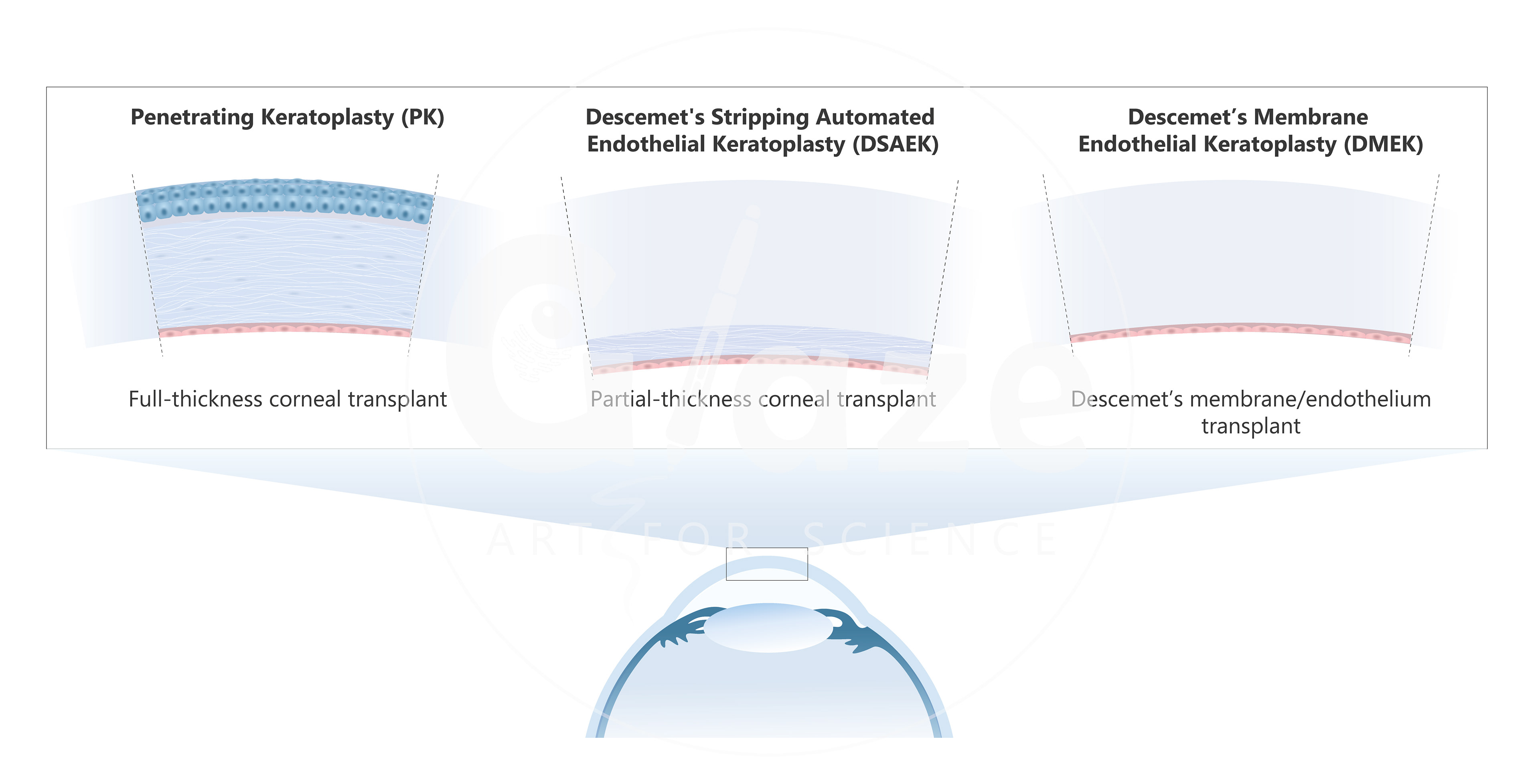 Corneal disease treatments