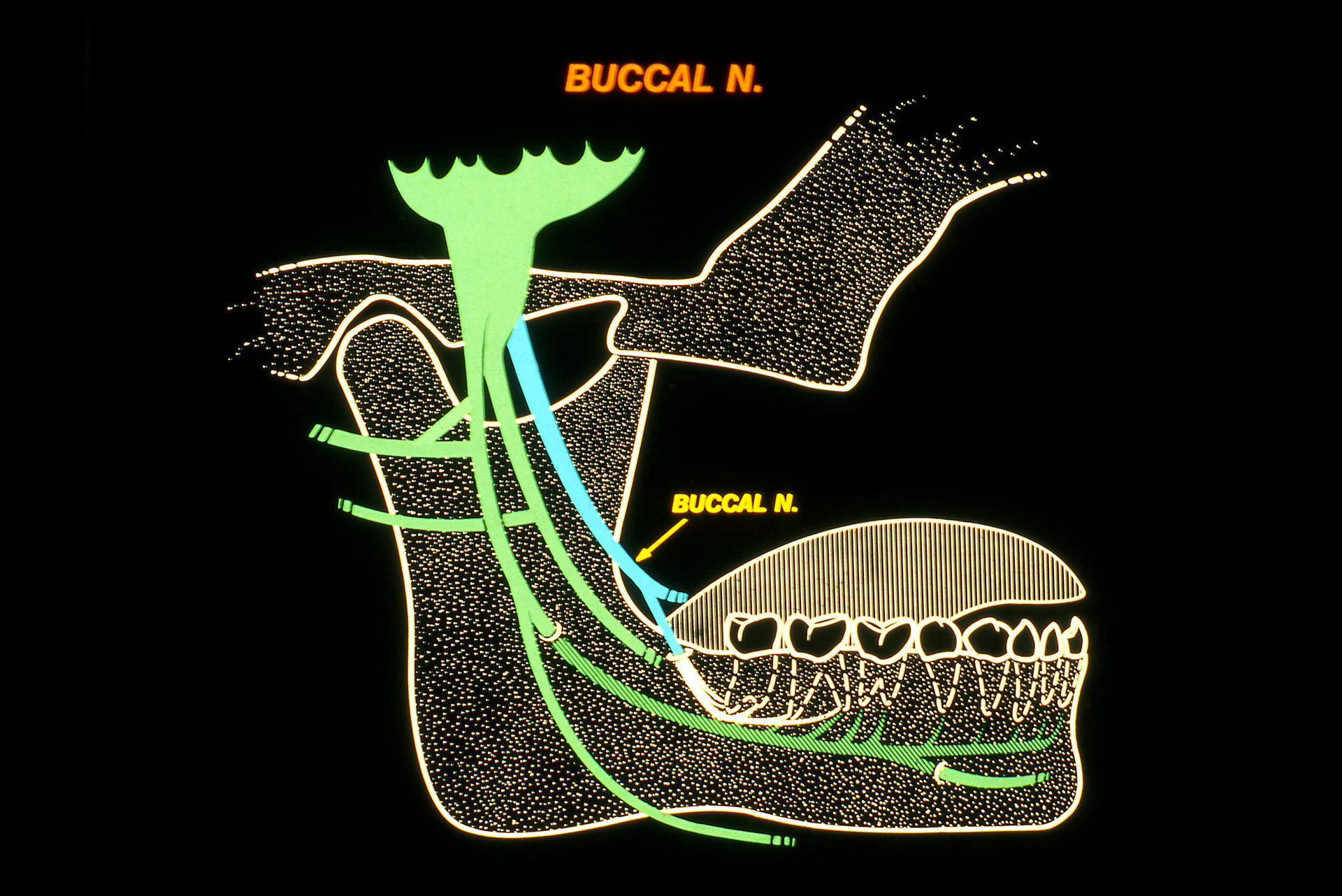 Mandibular Nerve Variations
