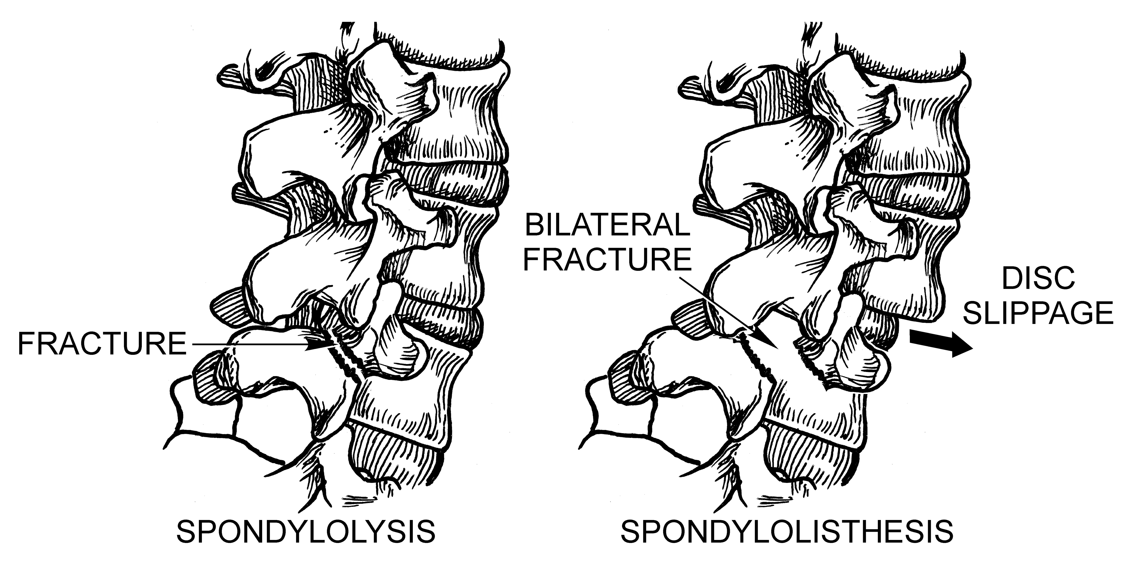 Spinal Anatomy and pathologies