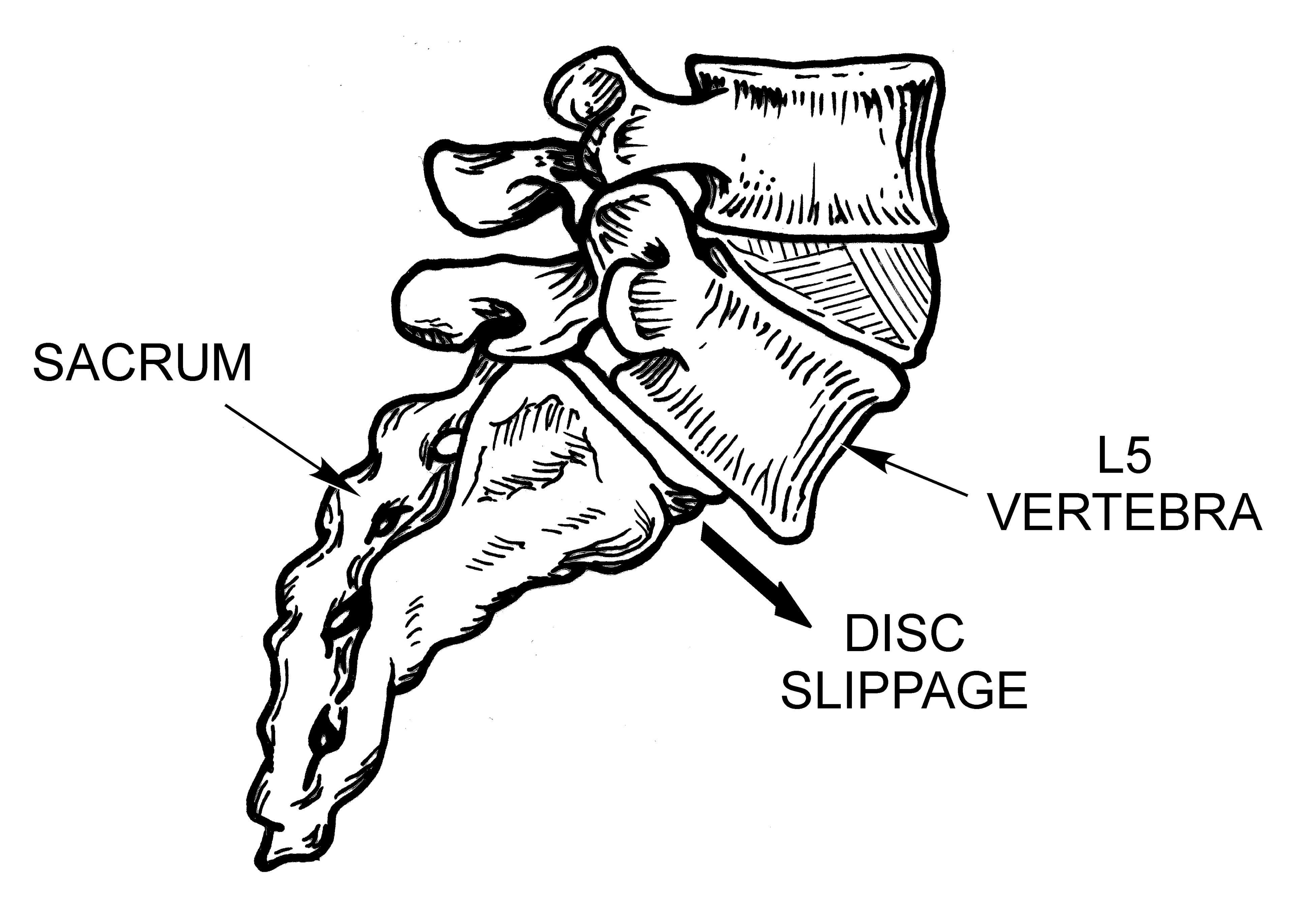 Spinal Anatomy and pathologies