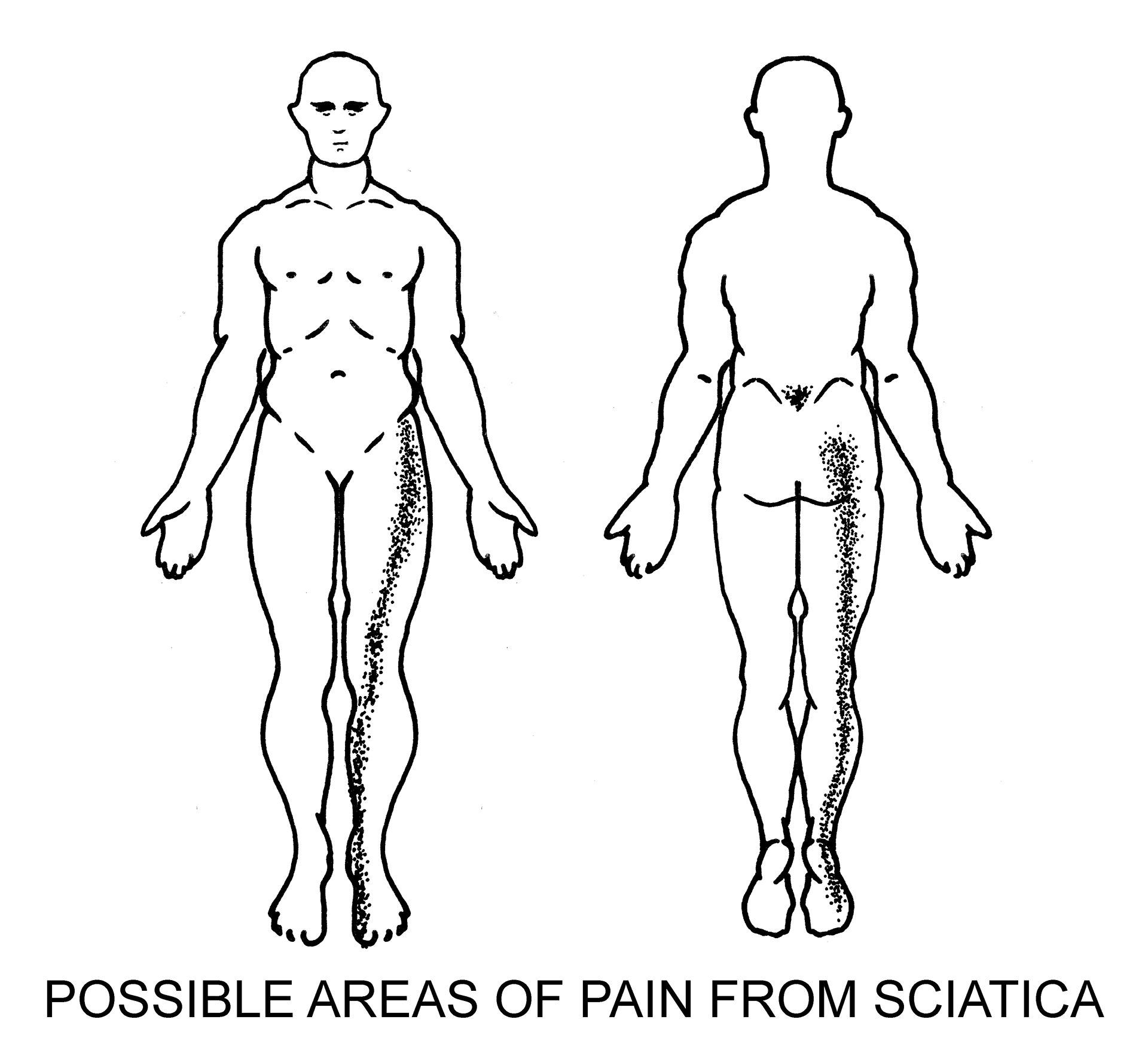 Spinal Anatomy and pathologies