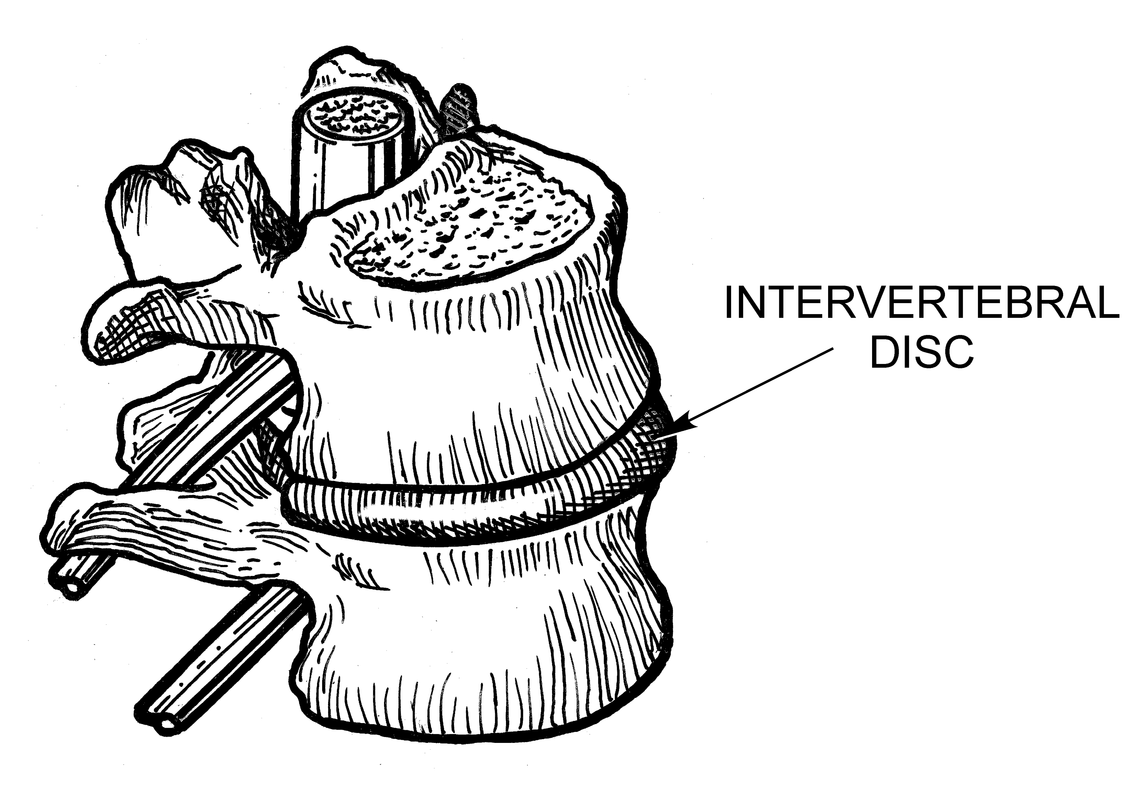 Spinal Anatomy and pathologies