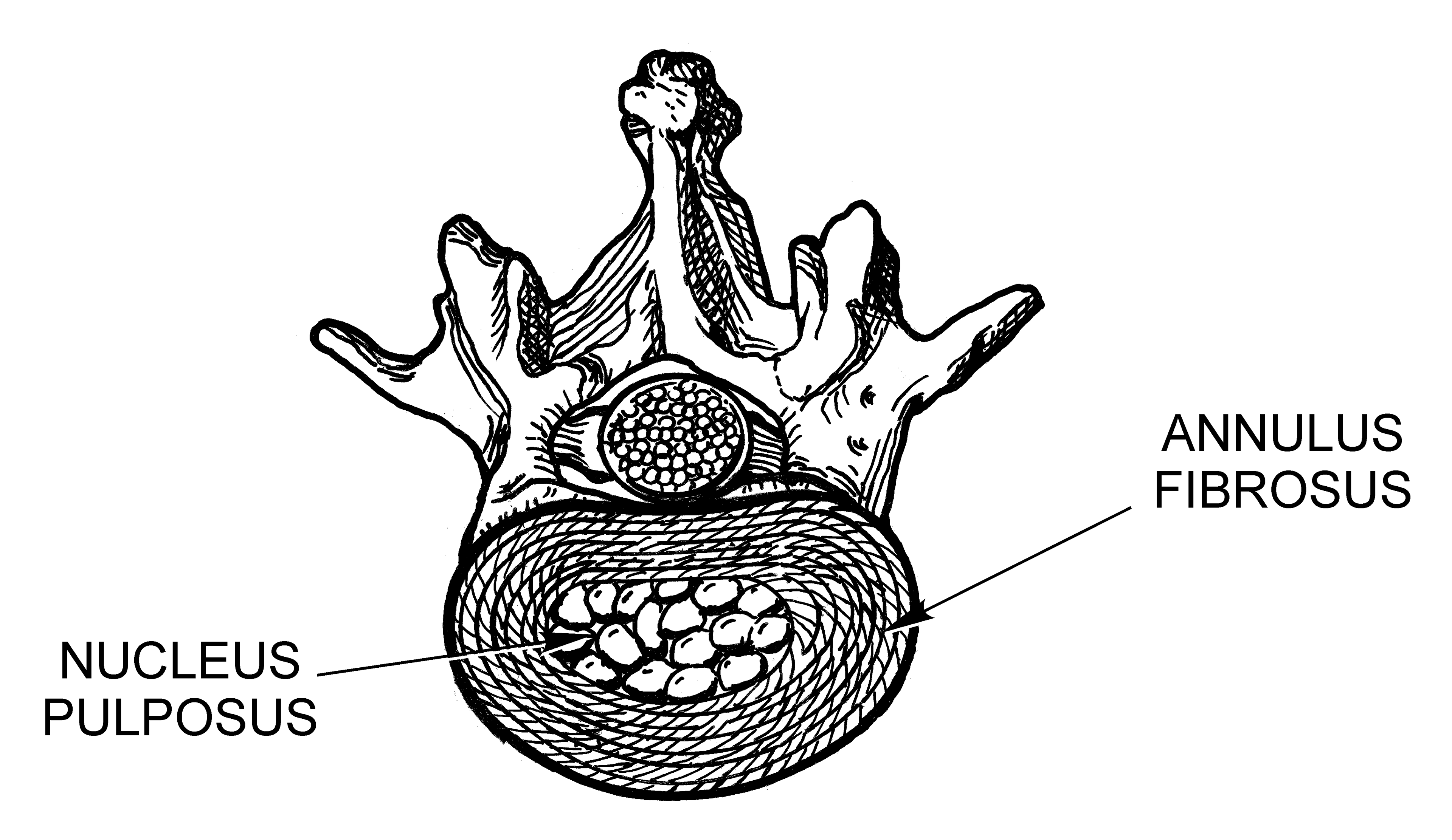 Spinal Anatomy and pathologies