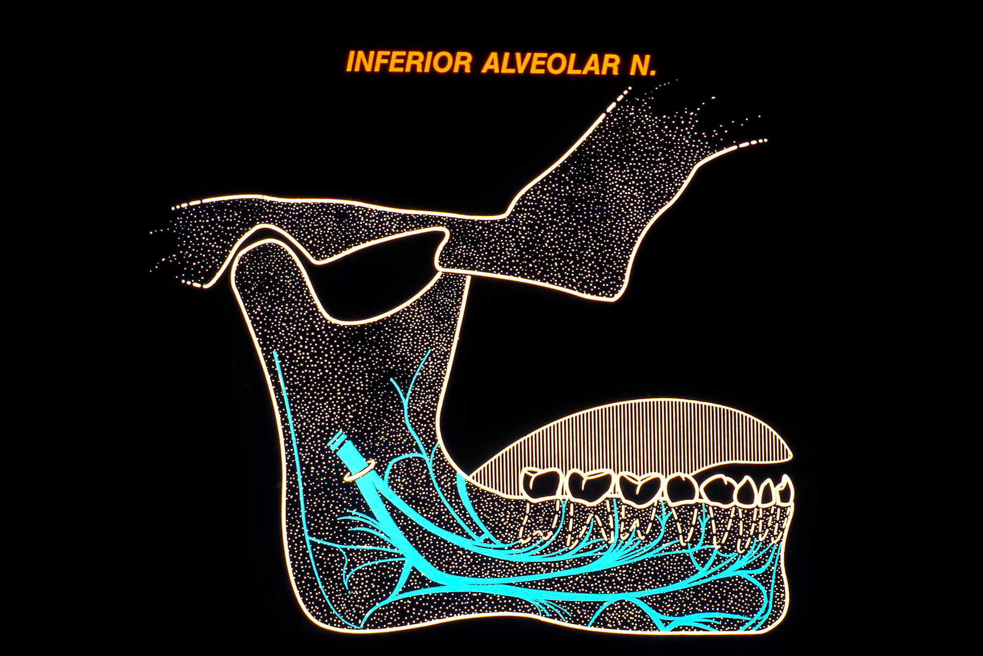 Mandibular Nerve Variations