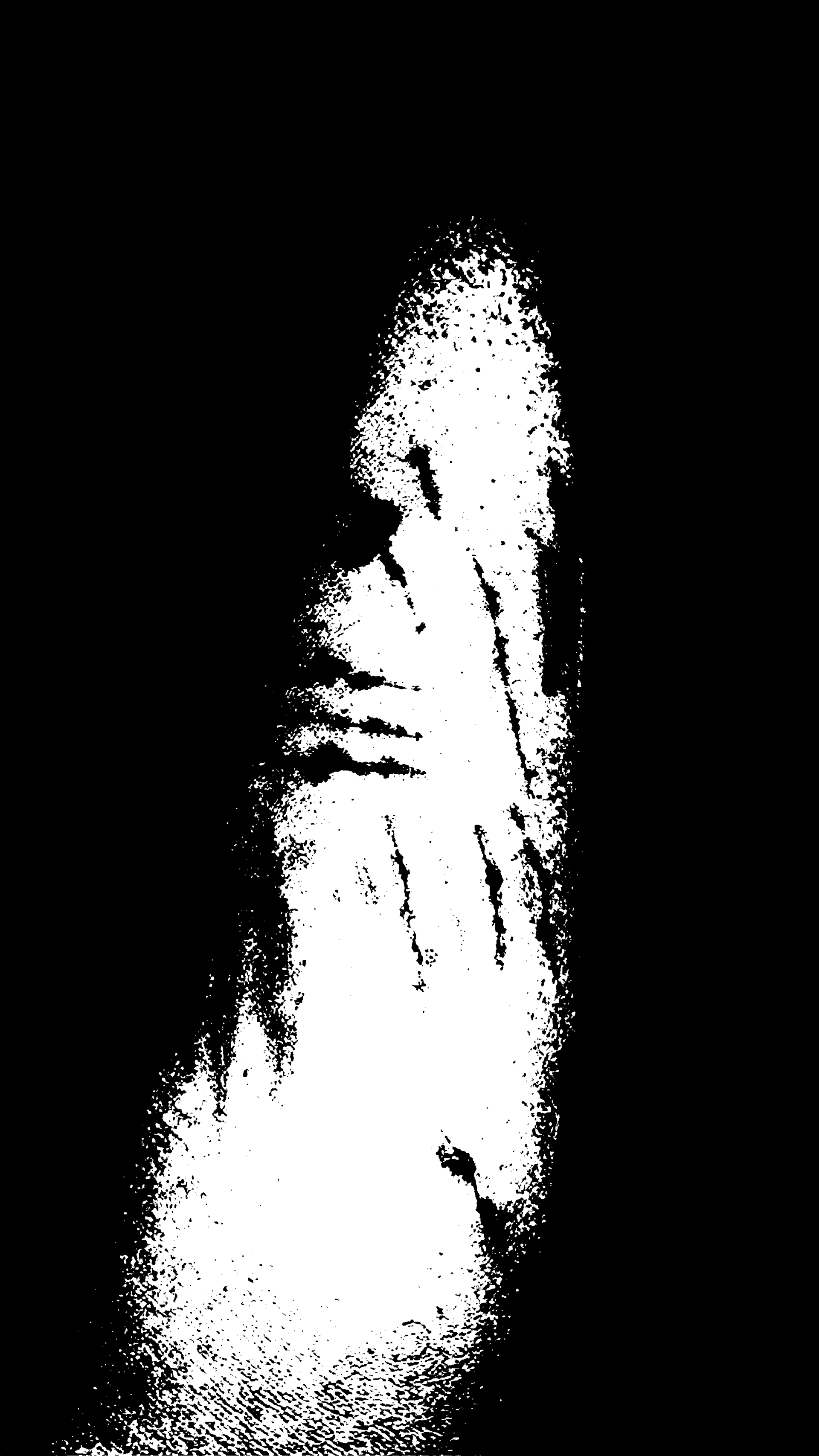 Digitally edited photograph of a human arm bearing visible scars, manipulated in Photoshop to create a textured, abstract visual that evokes emotional depth and personal struggle.