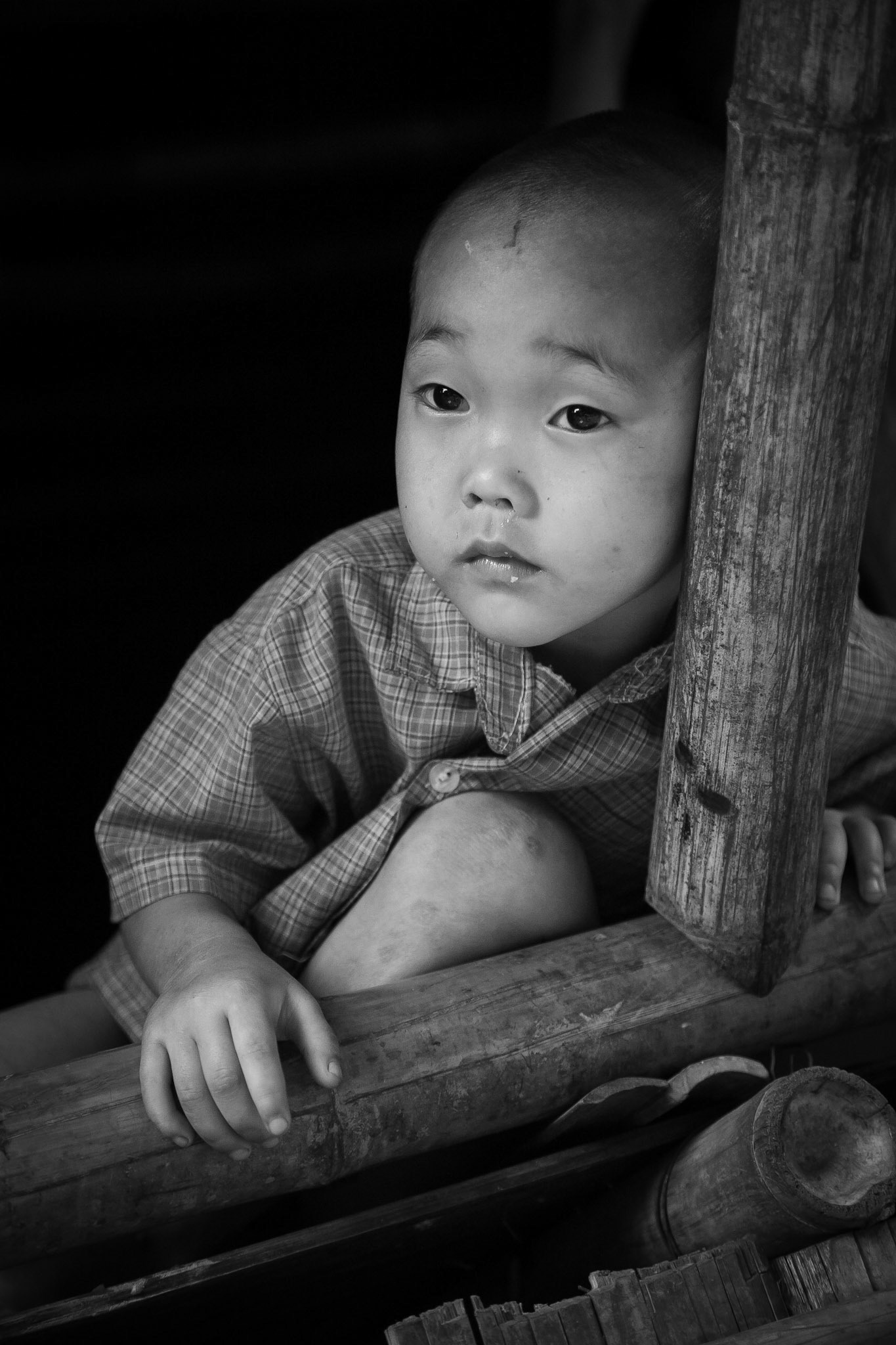 A young Burmese Karen refugee child stares wistfully while lying on a bamboo support.