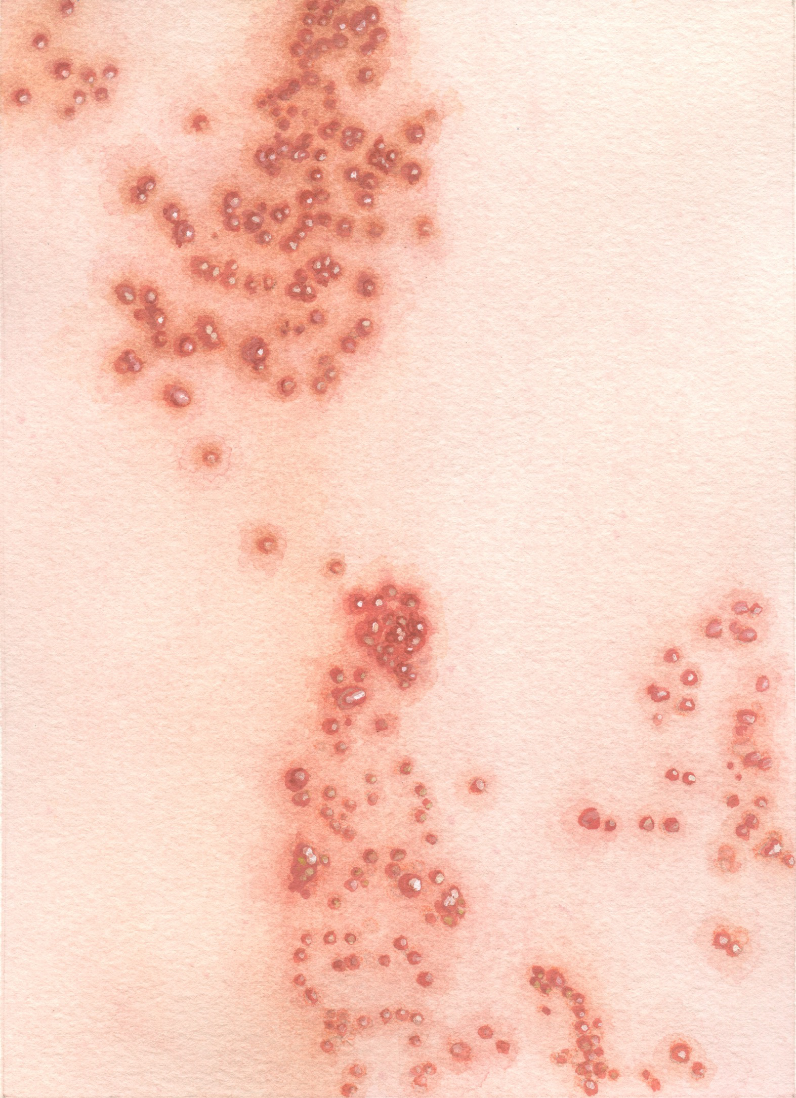 Fever. 2022. Watercolor on paper. 9"x12".