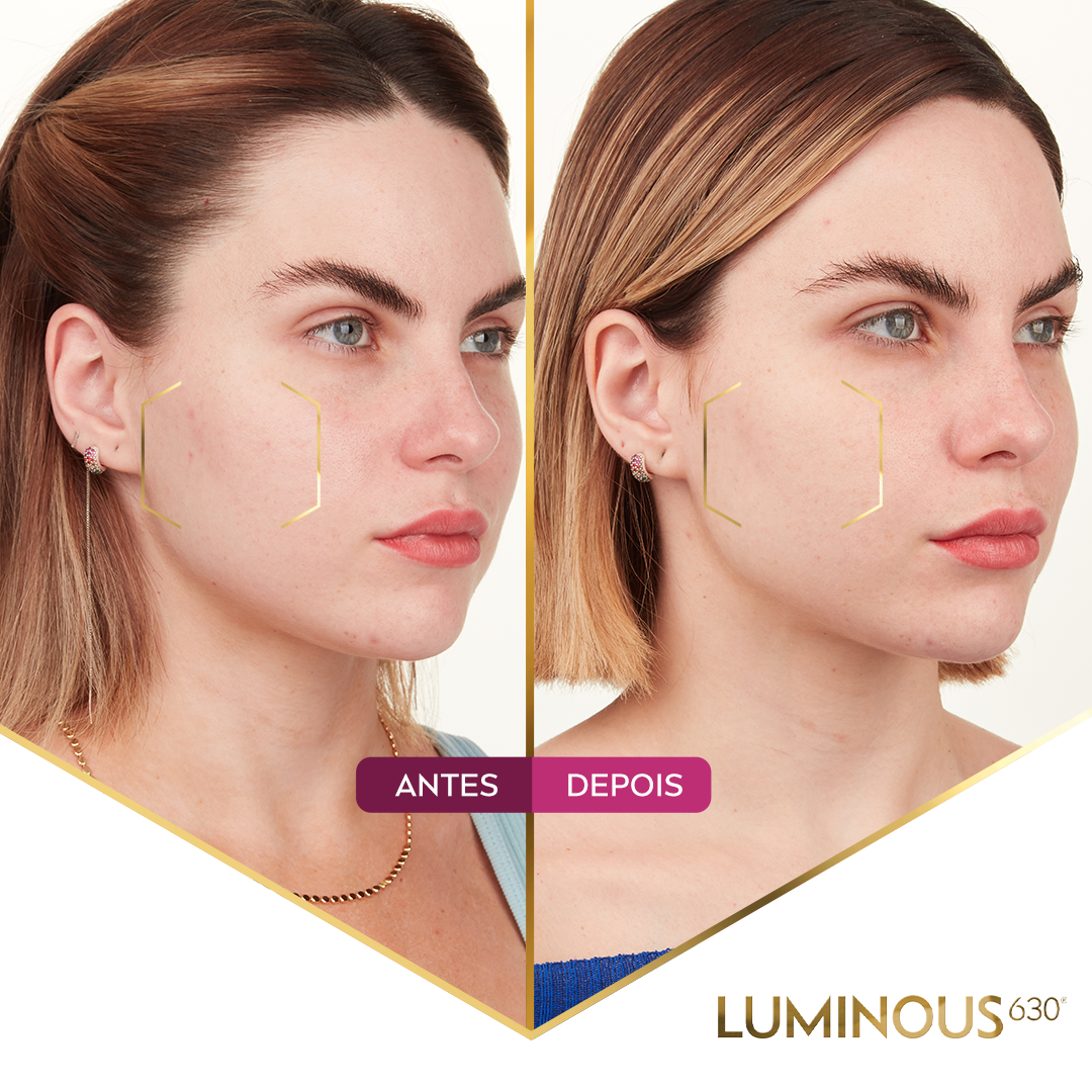 Nivea Luminous 360 - Before/After Campaign