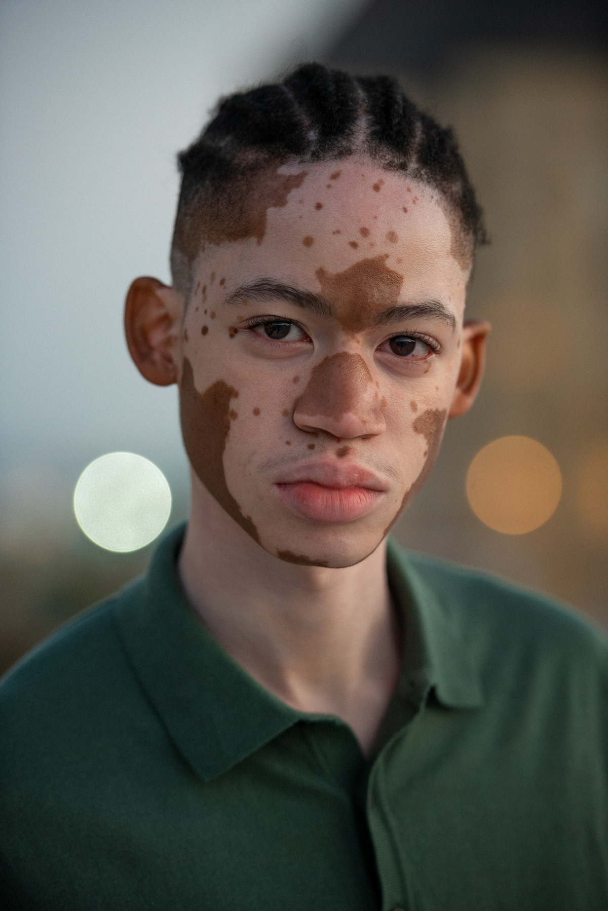 Original Crawford Man Model Male Winnie Harlow Vitiligo Skin Yannick Delva