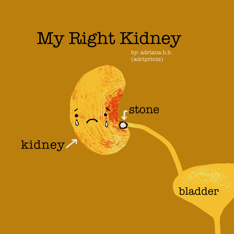 Kidney Stones Are Terrible