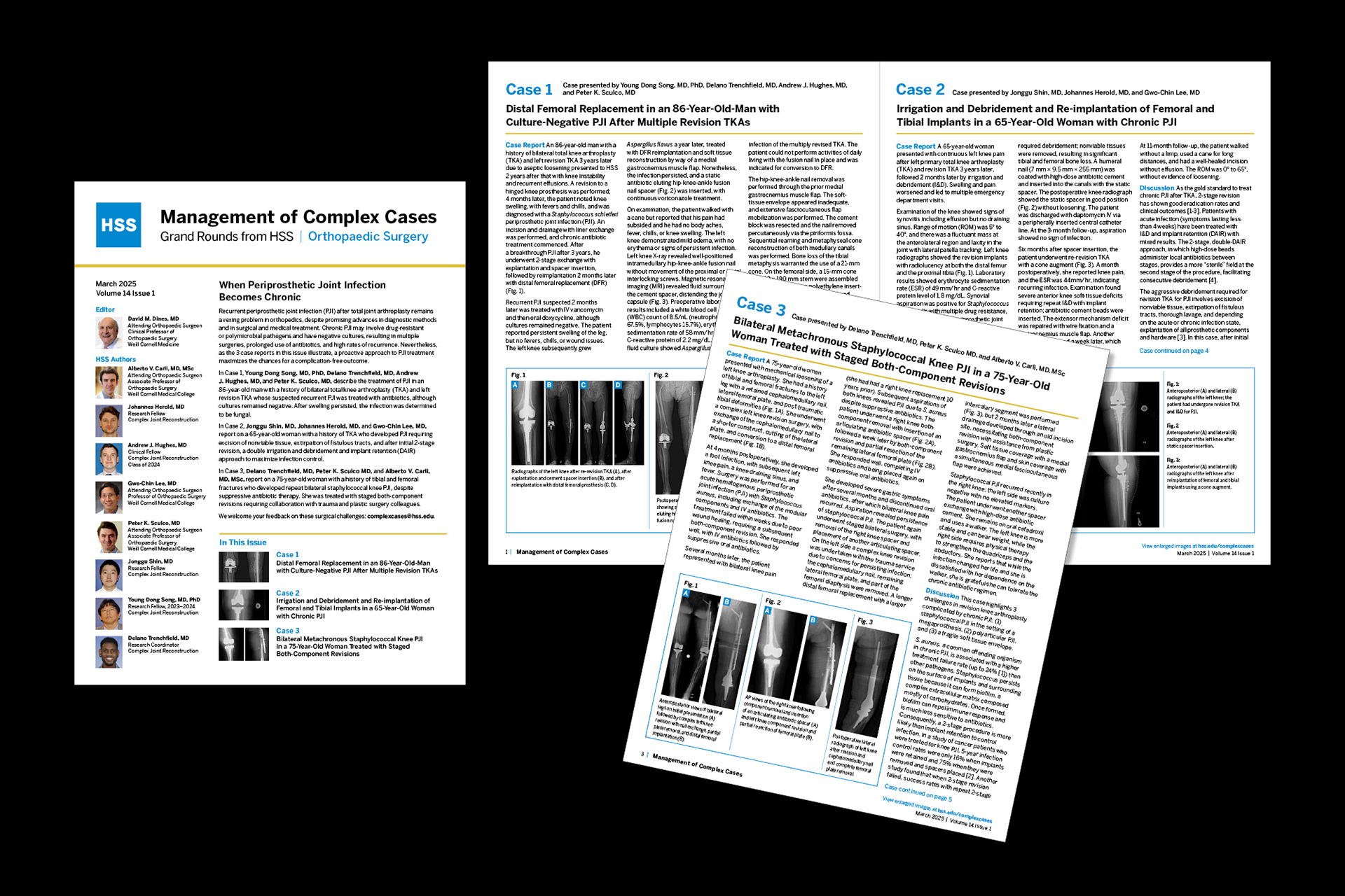 Grand Rounds from HSS/Management of Complex Cases-Ortho Surgery