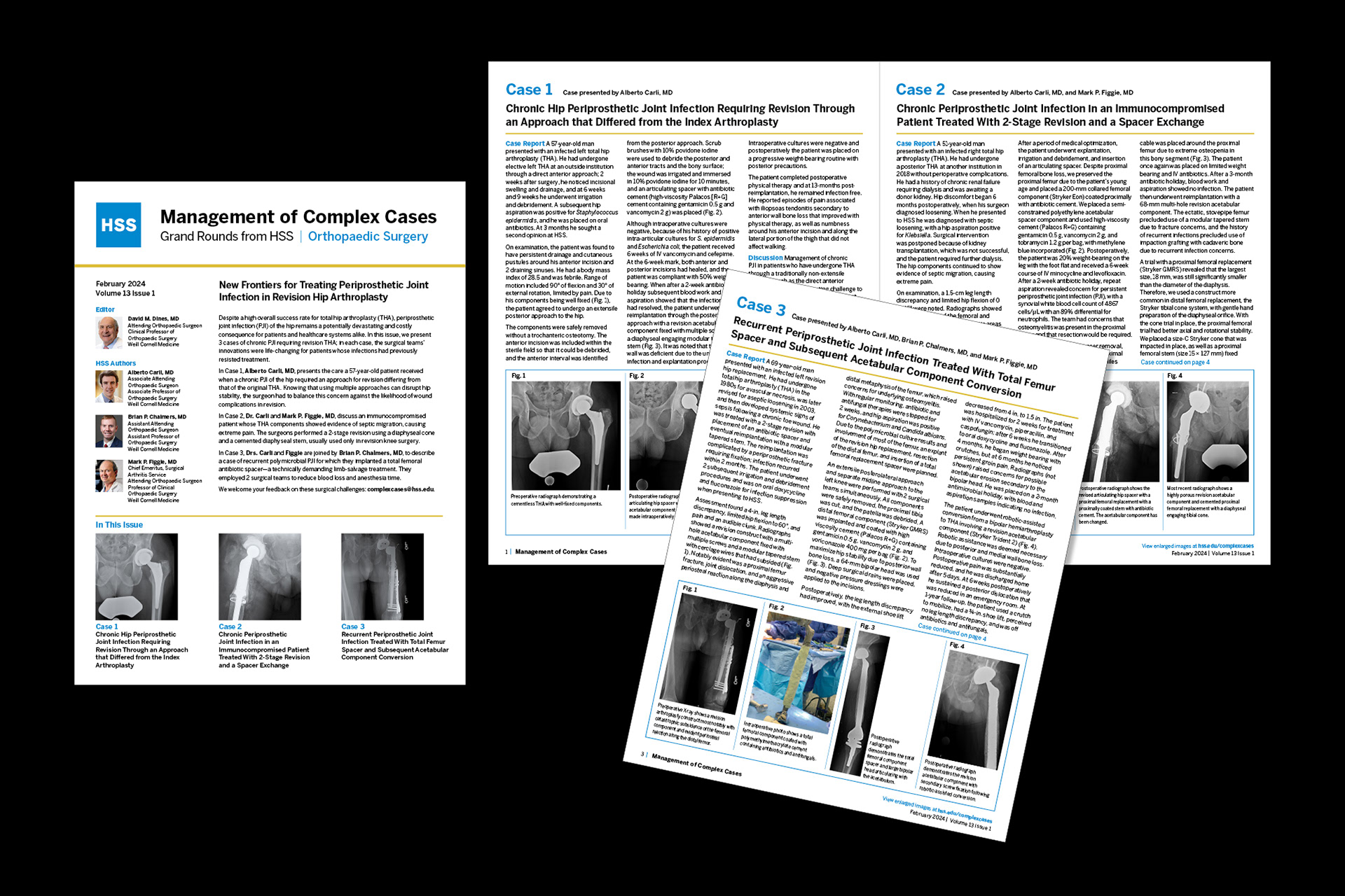 Grand Rounds from HSS/Management of Complex Cases-Ortho Surgery