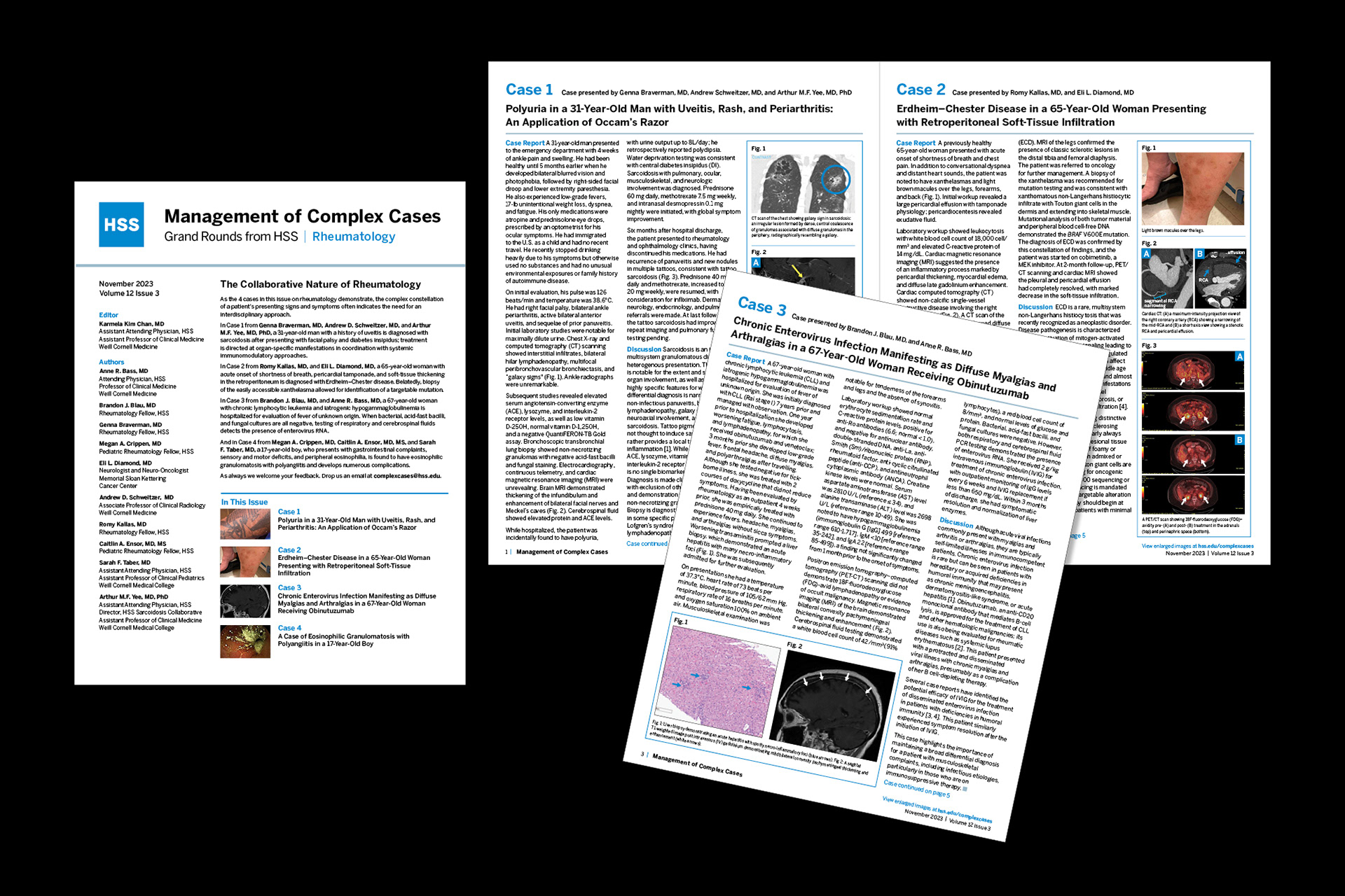 Grand Rounds from HSS/Management of Complex Cases-Rheumatology