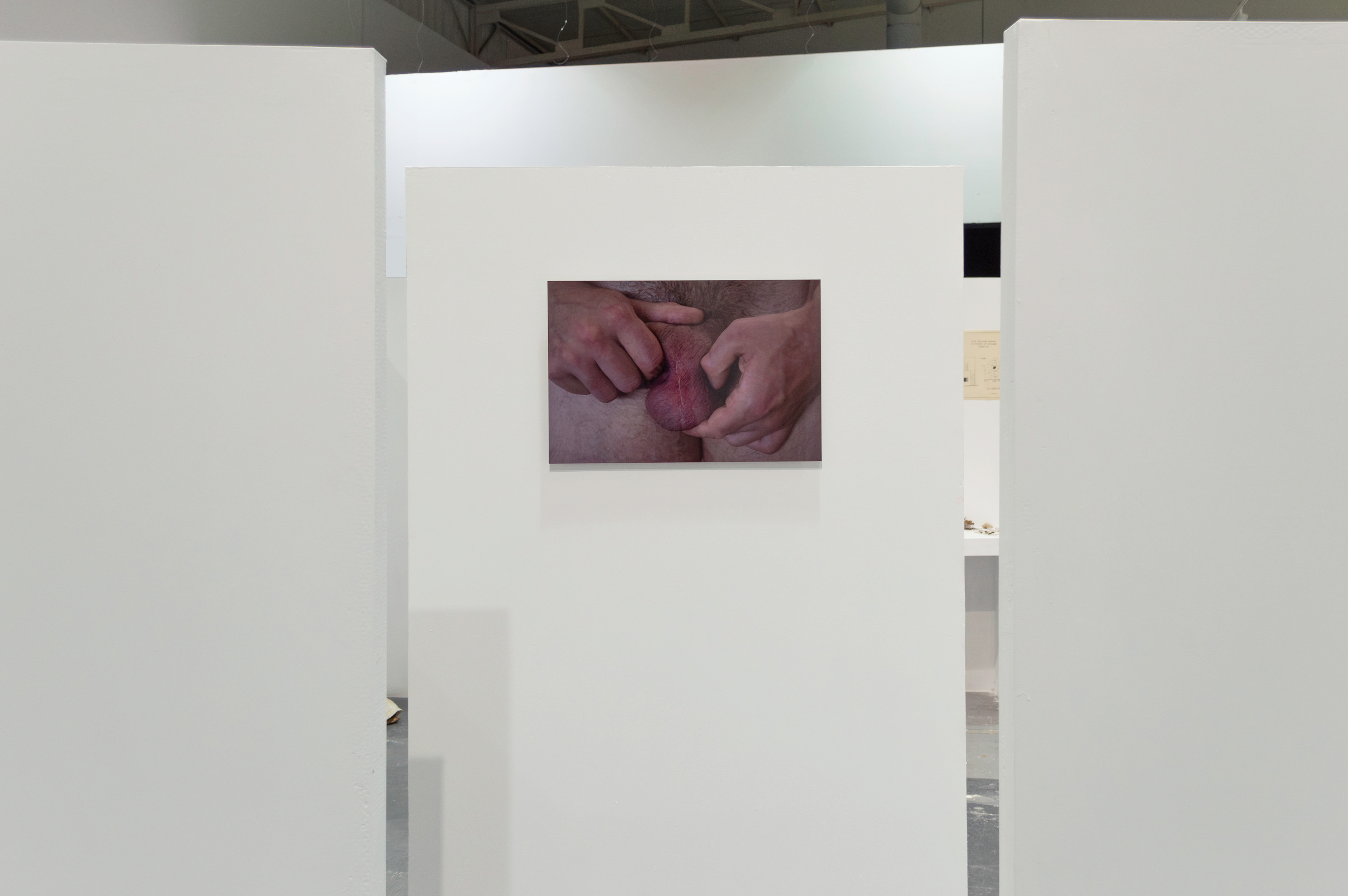 The incision on the scrotum, as a scar and a memory on the body, marks the entry into a conceptual space and acknowledges the absence of a testicle.