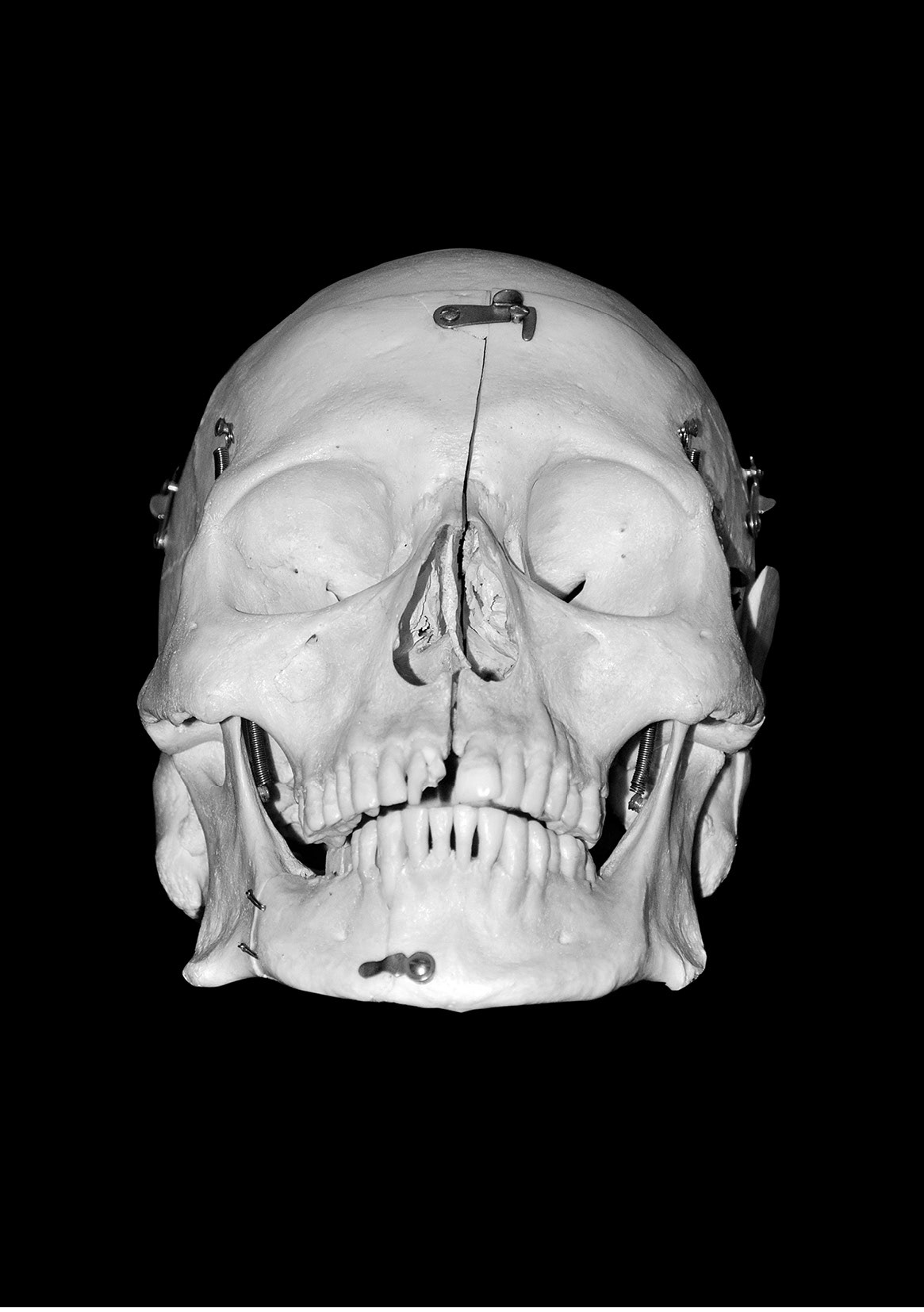 Black & White Skull | Digitale Fotoretusche
