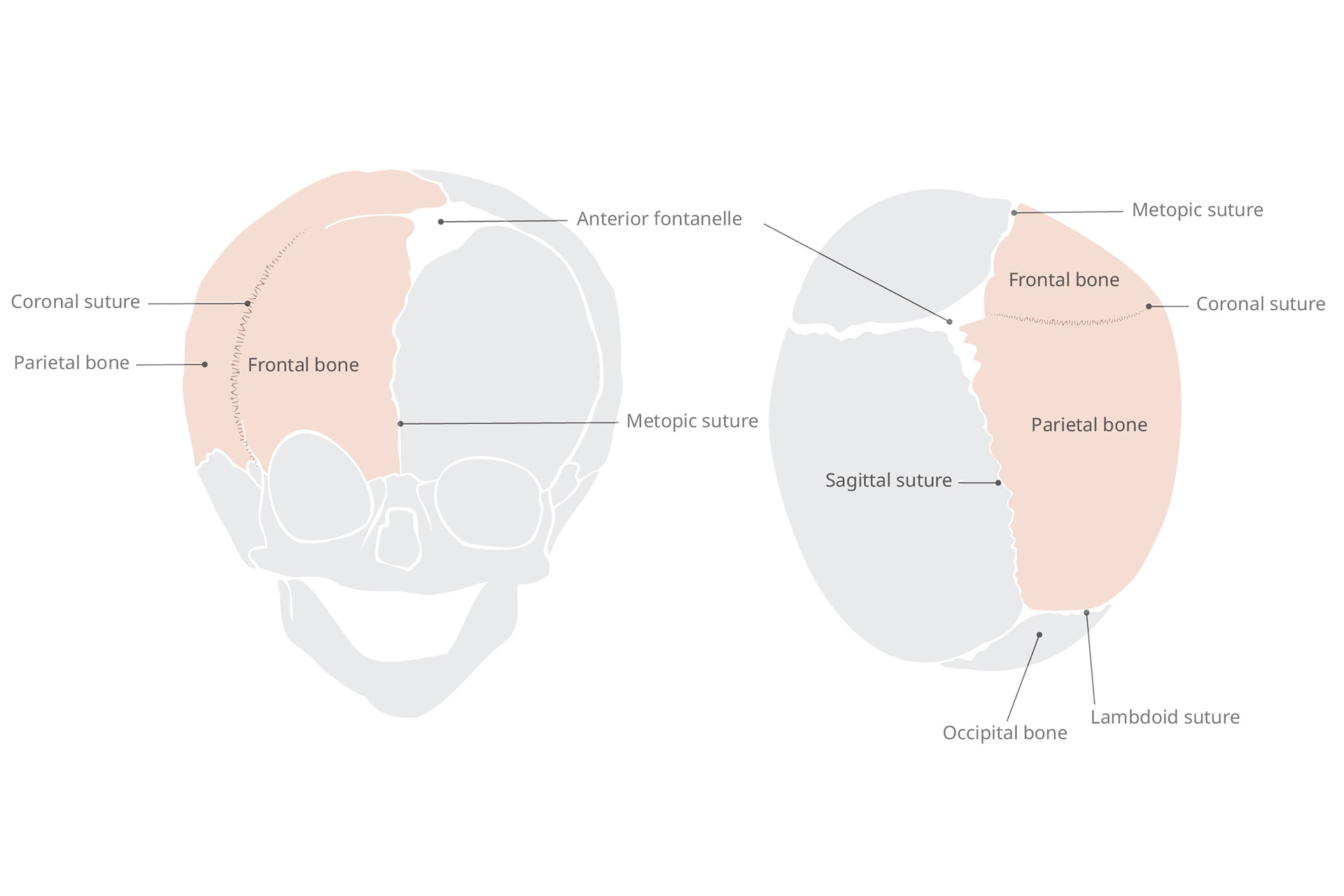 Cranio Anomaly - Unilateral Coronal Suture