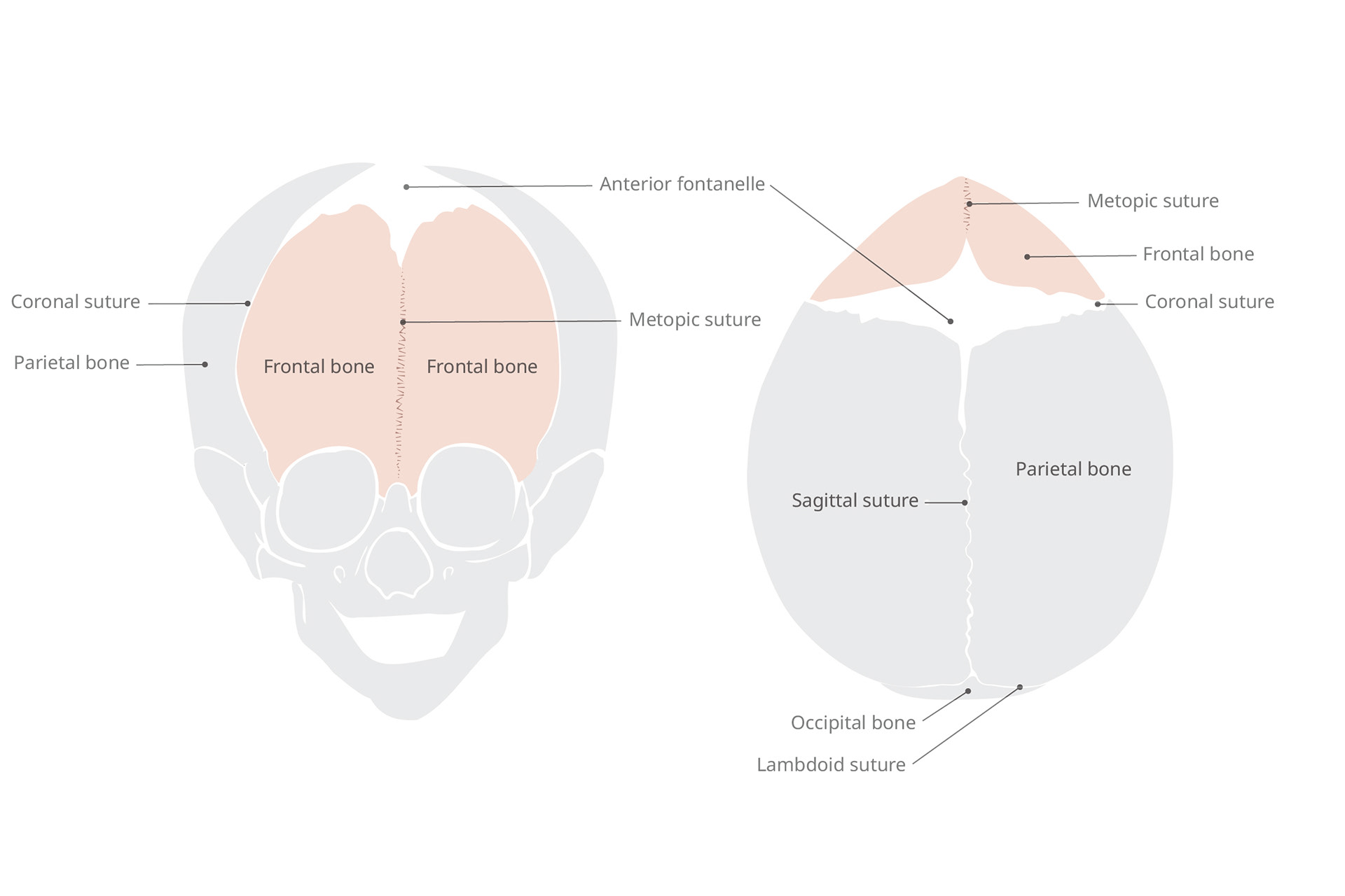 Cranio Anomaly - Metopic Suture