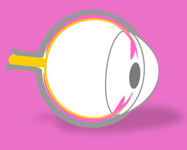 Uveitis