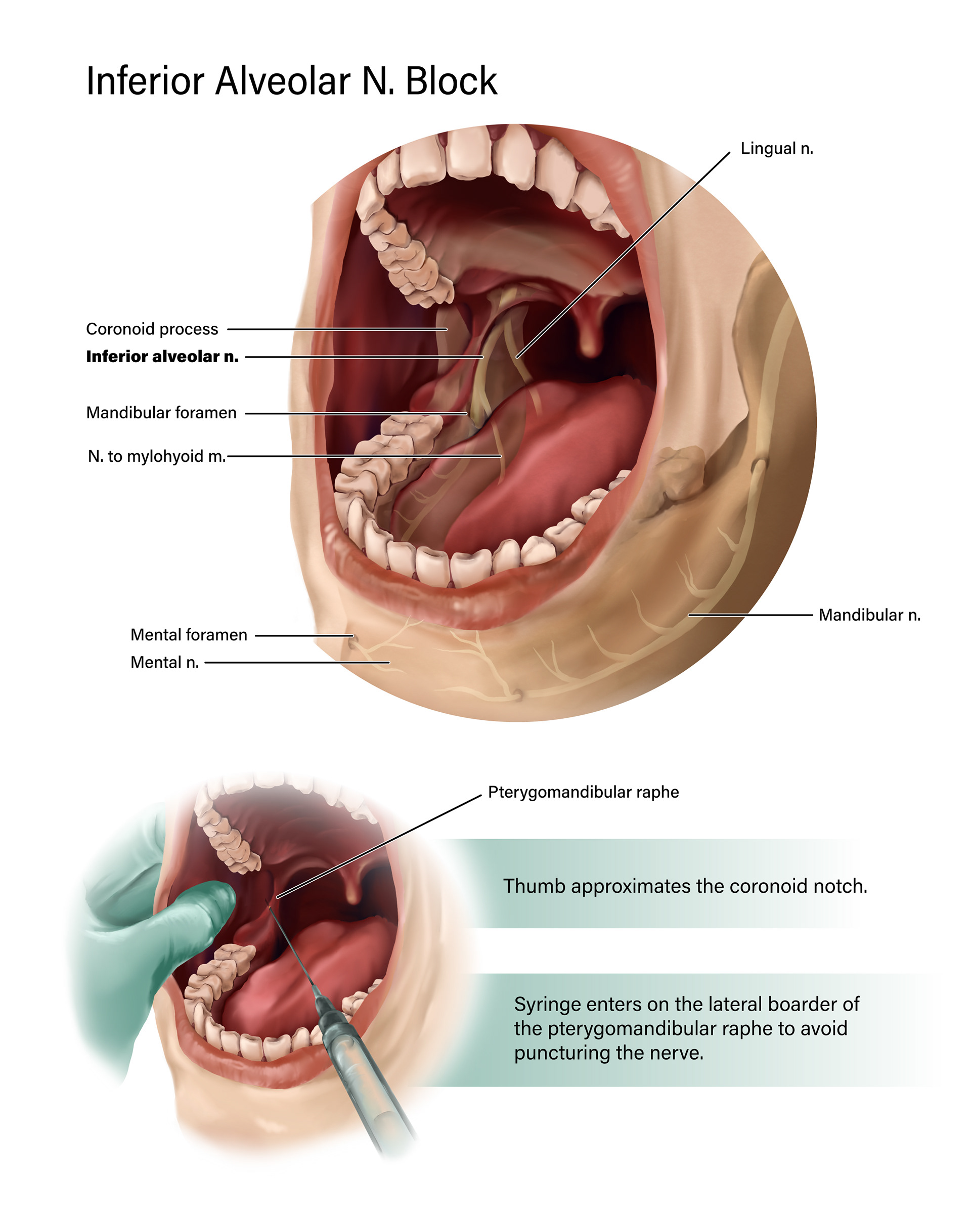 Transview didactic