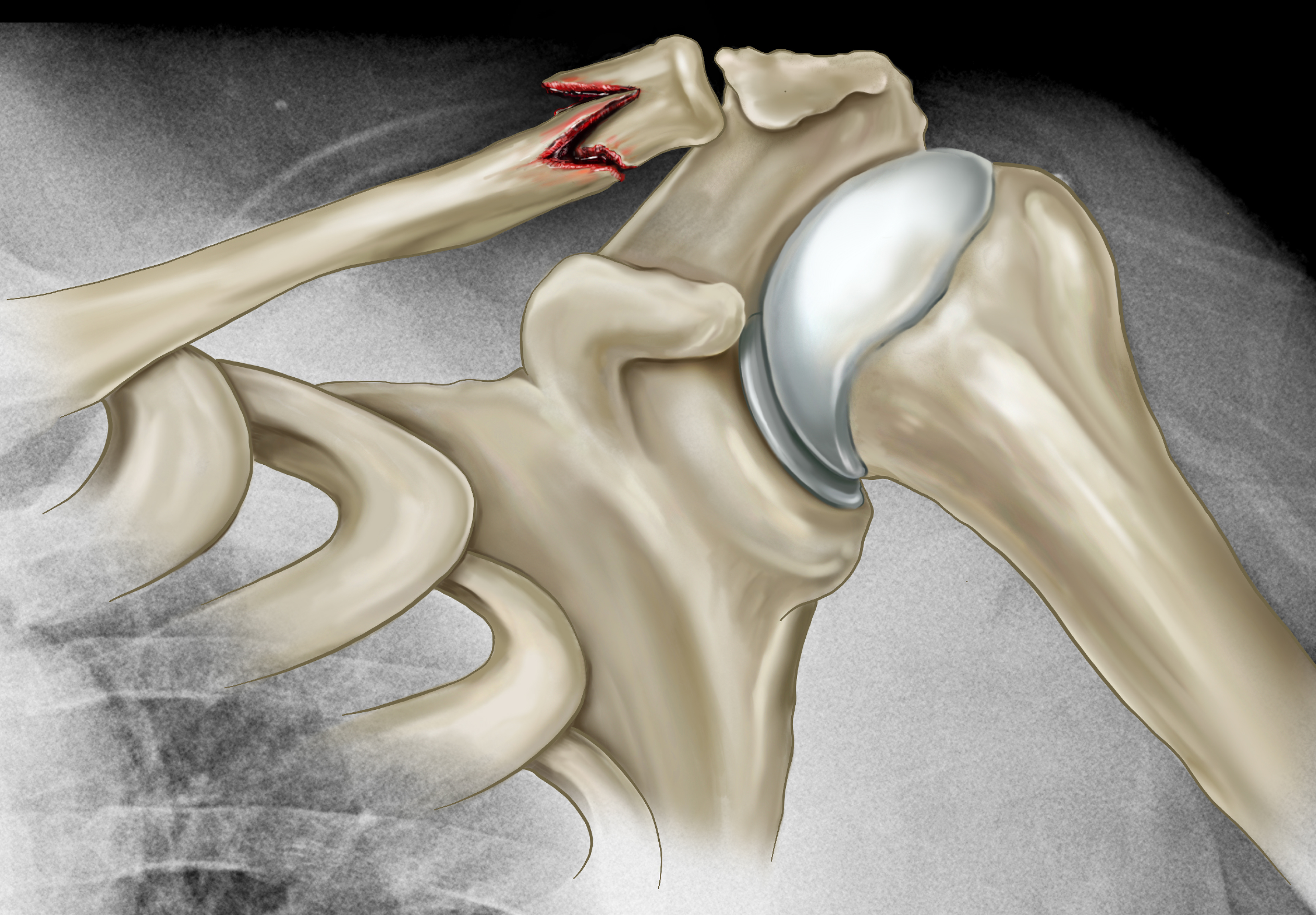Scan Colorization. Produced for use by ION Medical Designs.