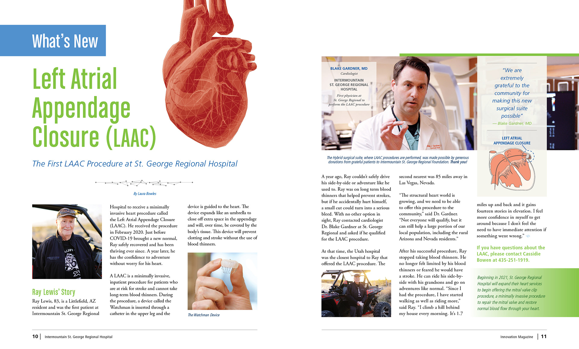 Left Atrial Appendage Closure (LAAC) spread
