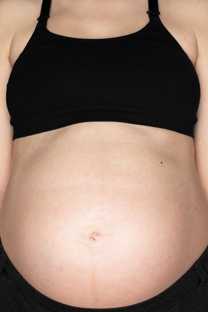 Pregnancy In The Time Of Corona (25 weeks)