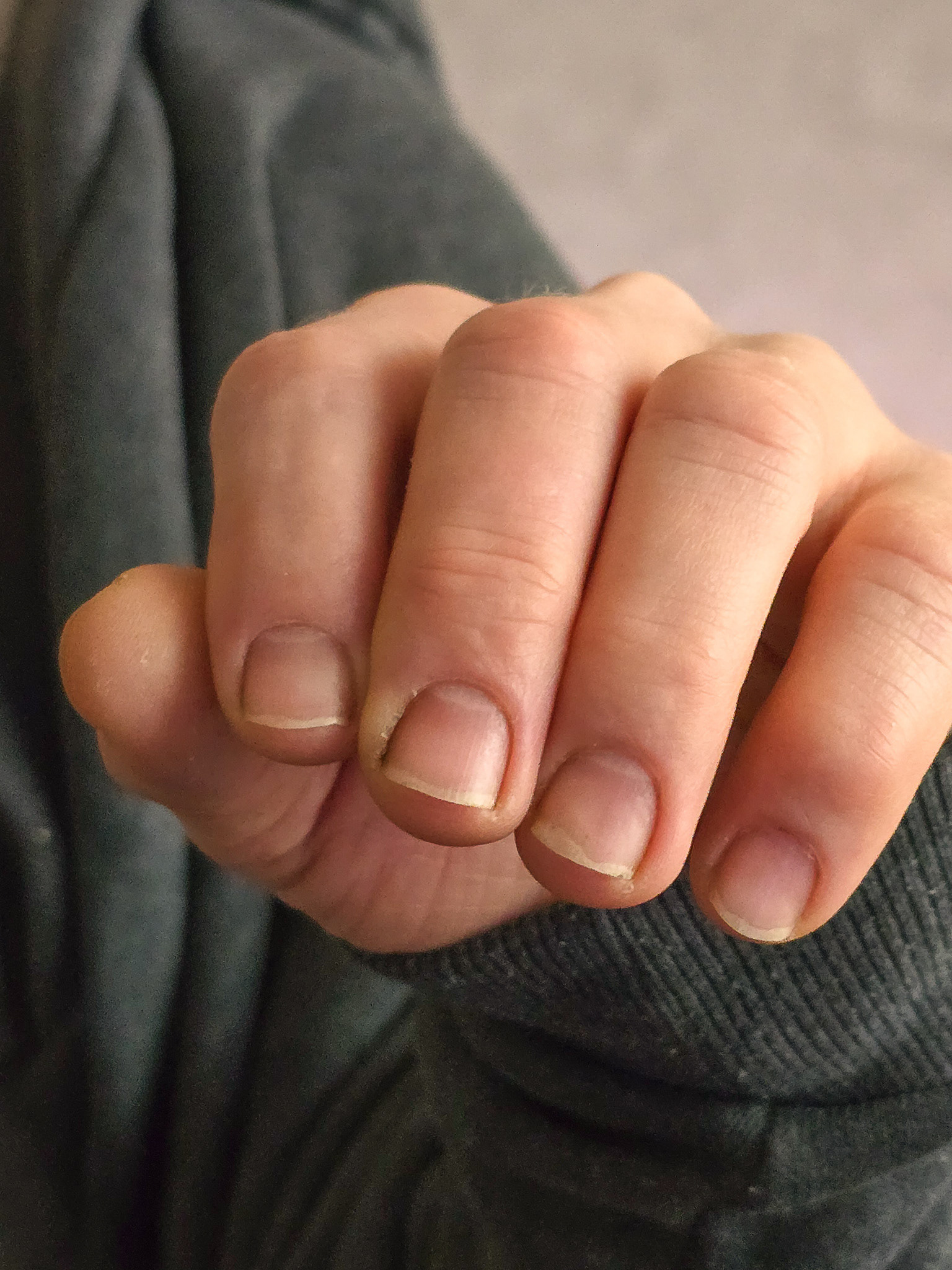 PŘED = stav před dnešní manikúrou. Tyhle ruce mám v péči už asi 3 měsíce, takže už je na nich vidět pravidelná údržba - jsou to ruce muže, co maká u stroje – takže tady se fakt testuje manikúra v reálném provozu