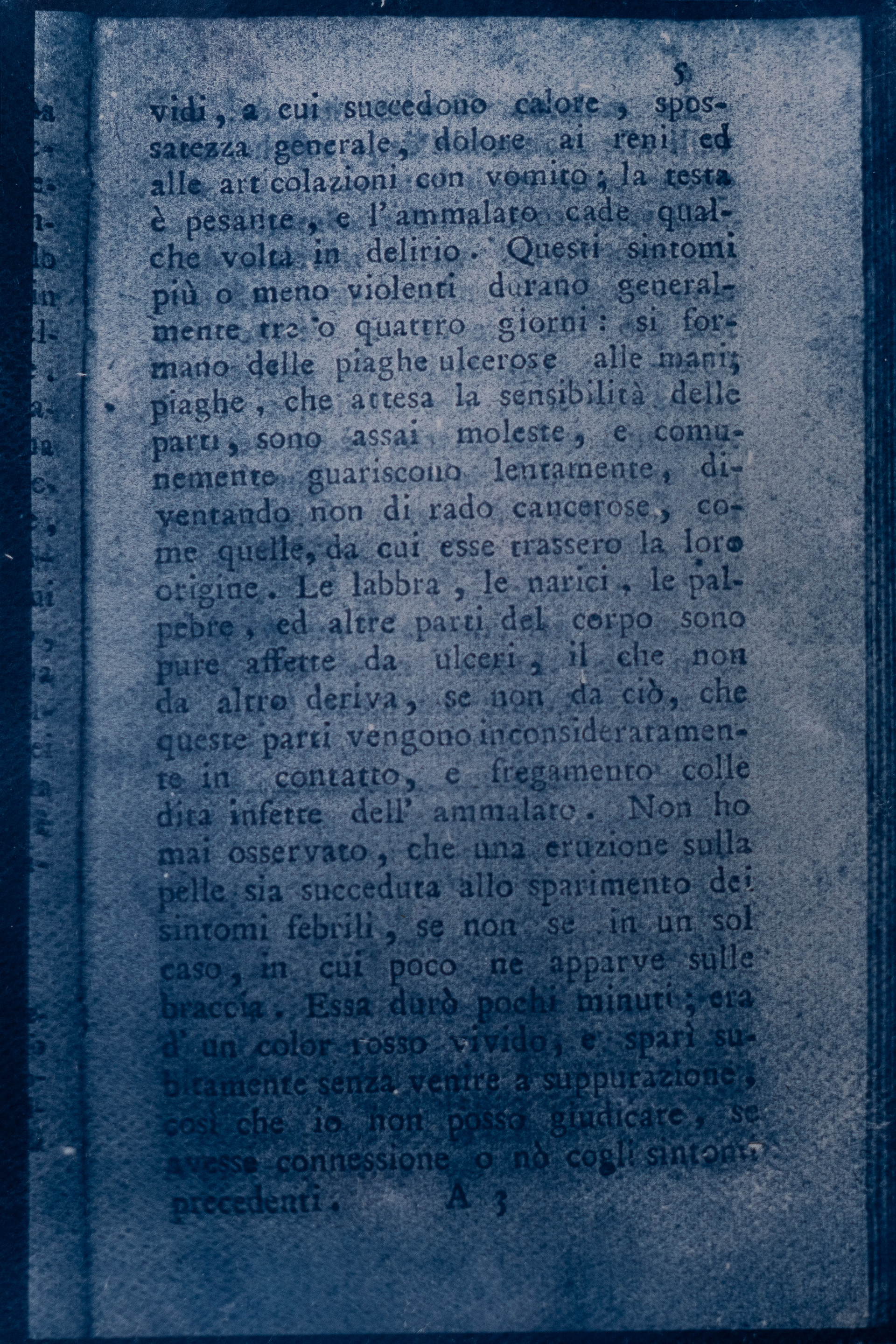 Effetti sul Vaiolo, Edward Jenner - Biblioteca della Città di Arezzo