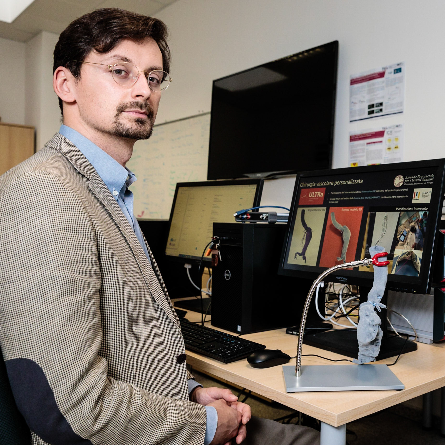 Università di Trento,Povo, Libertario Demi. 27 maggio 2021. Stampa 3D di aorta.