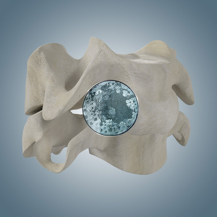 Bone density simulation