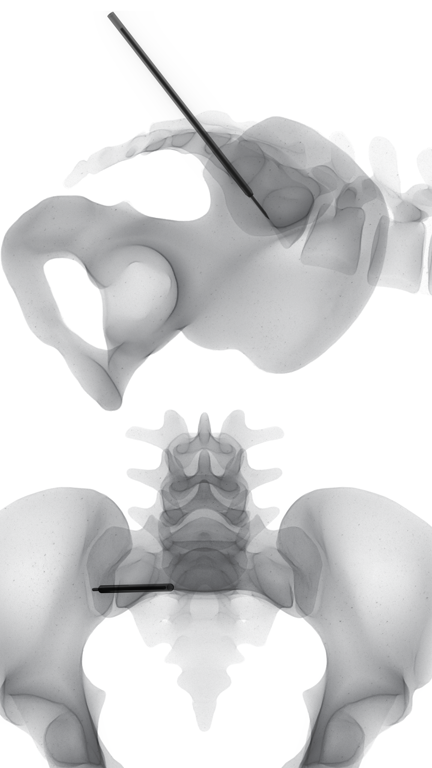 Fluoroscopy Simulation