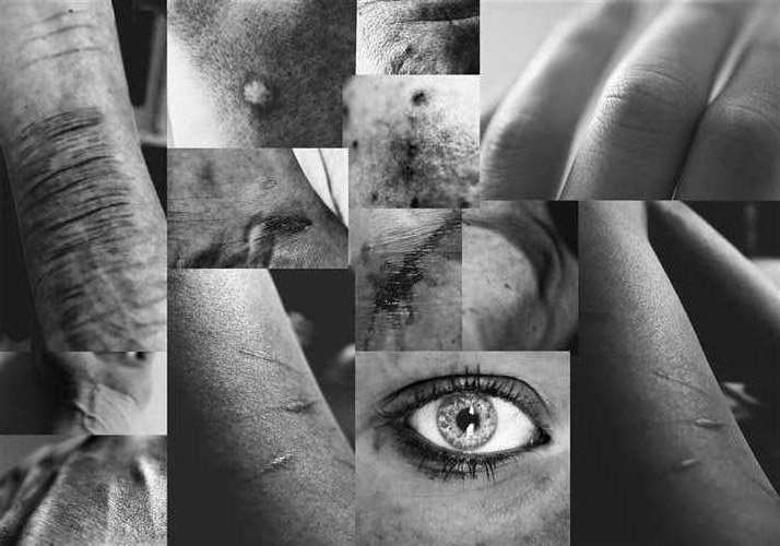 Liv MacPhail, Hathaway Brown School,12th,skin Impurities,Photography,Shelly Ahern, Gold Key