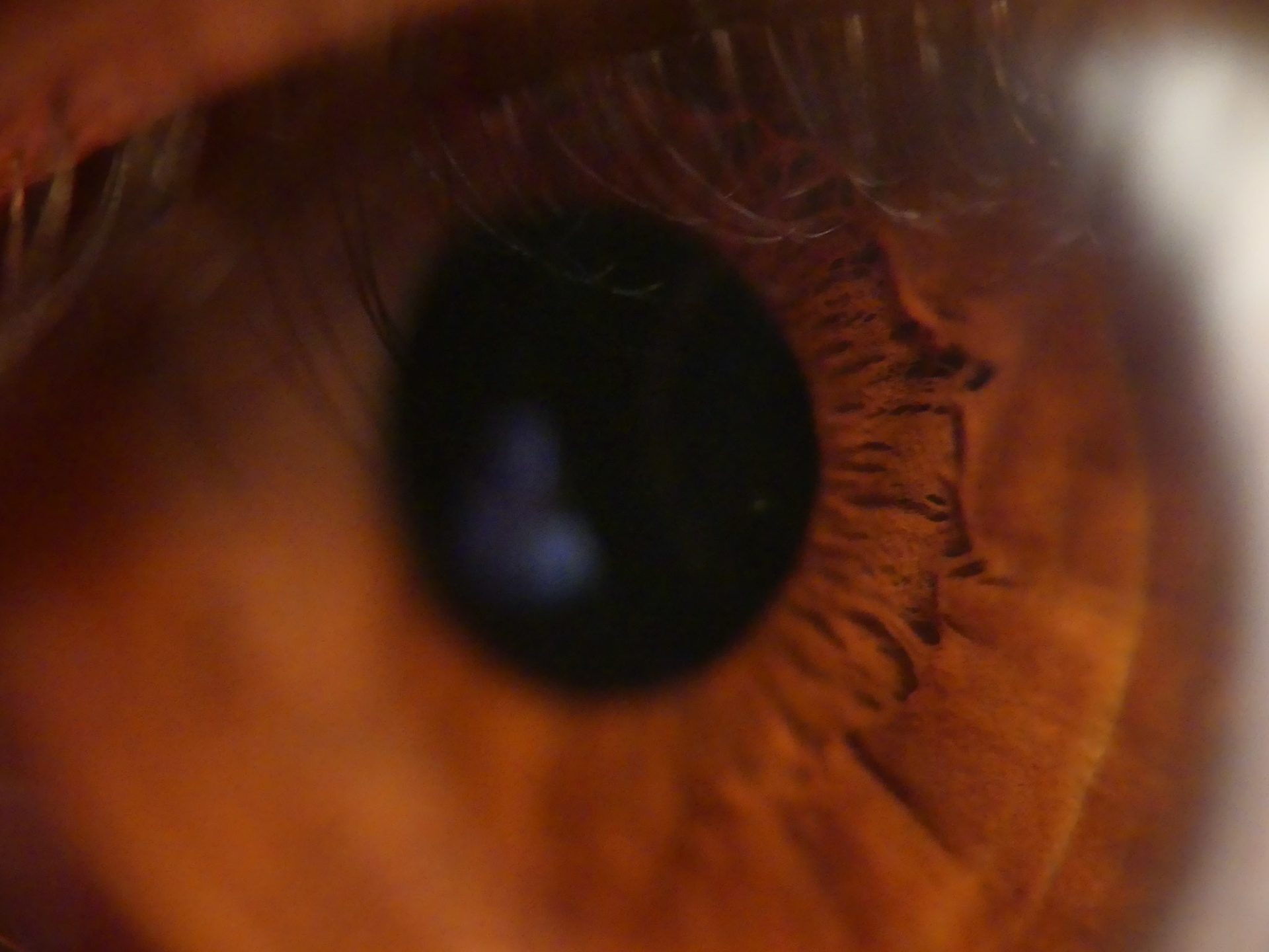 Eye from the side