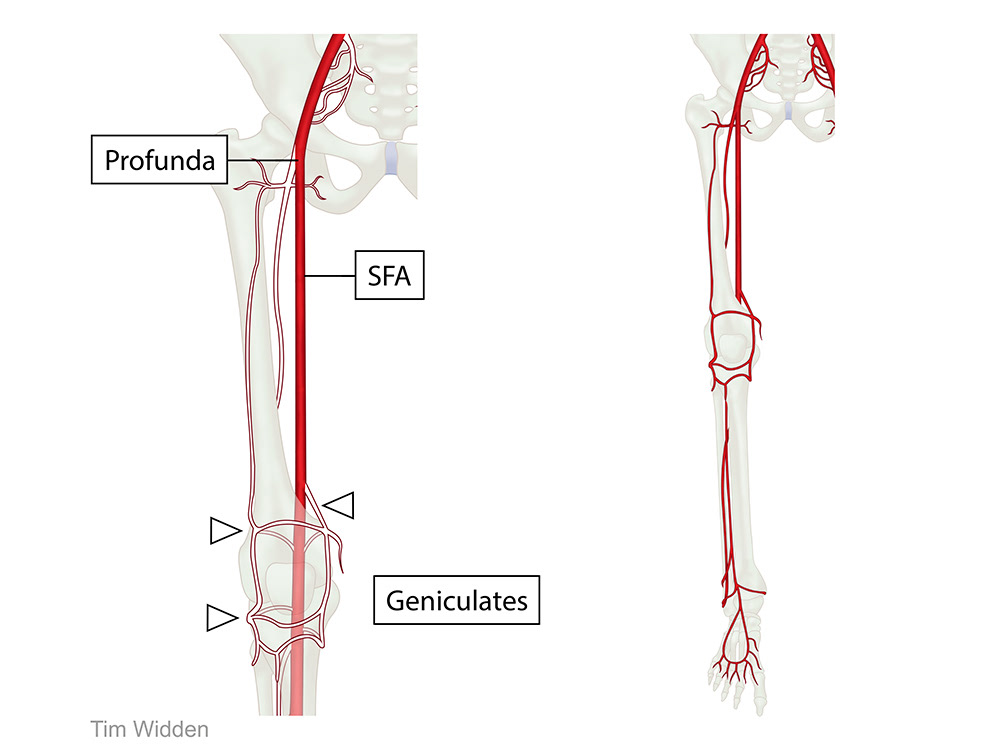 superficial femoral artery anatomy