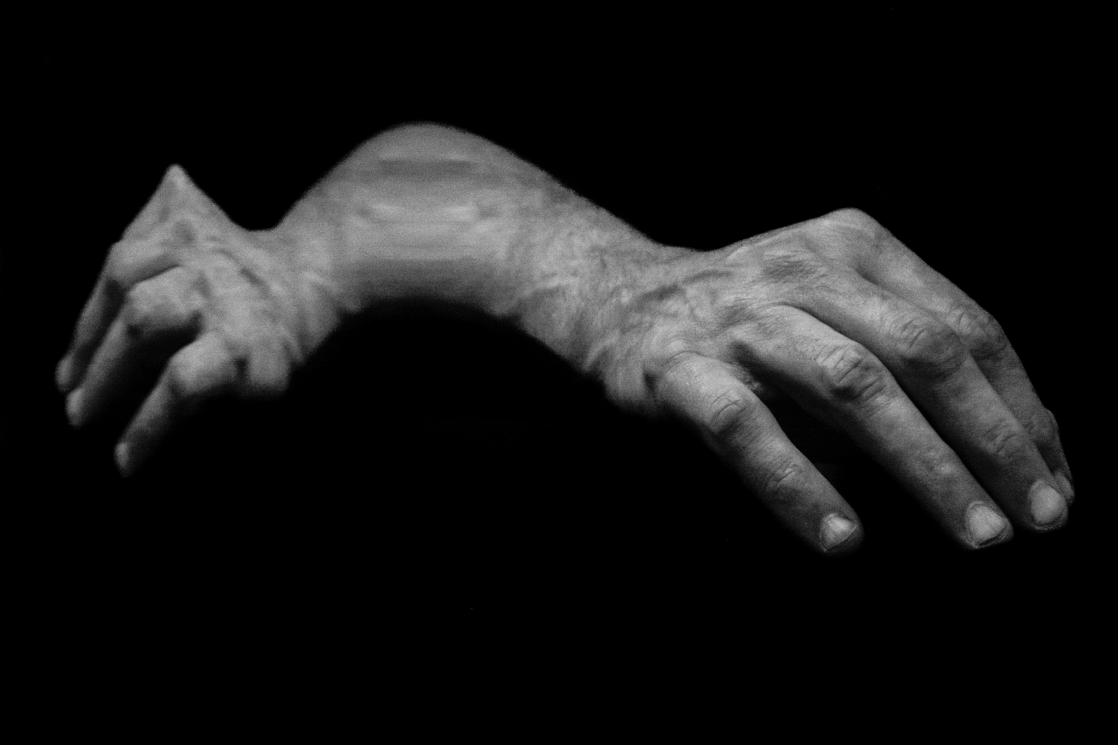 Distortions, the hand series