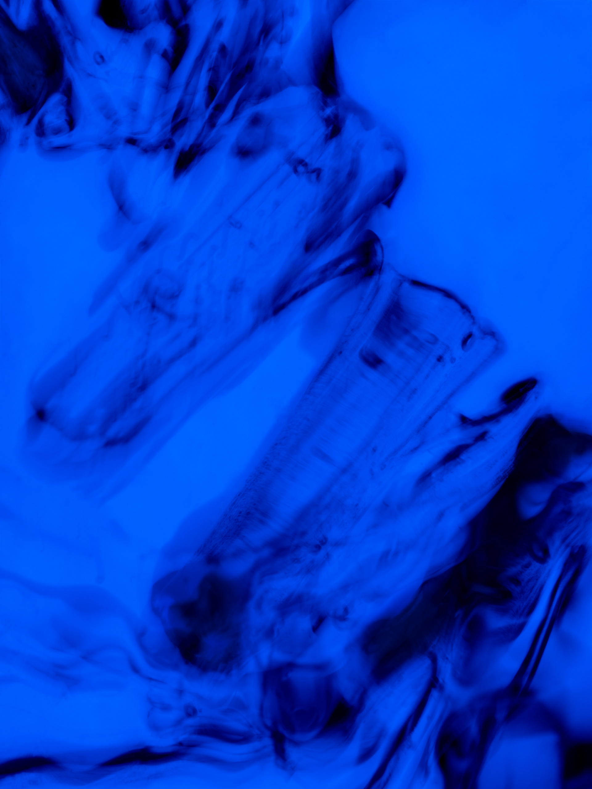 Excess