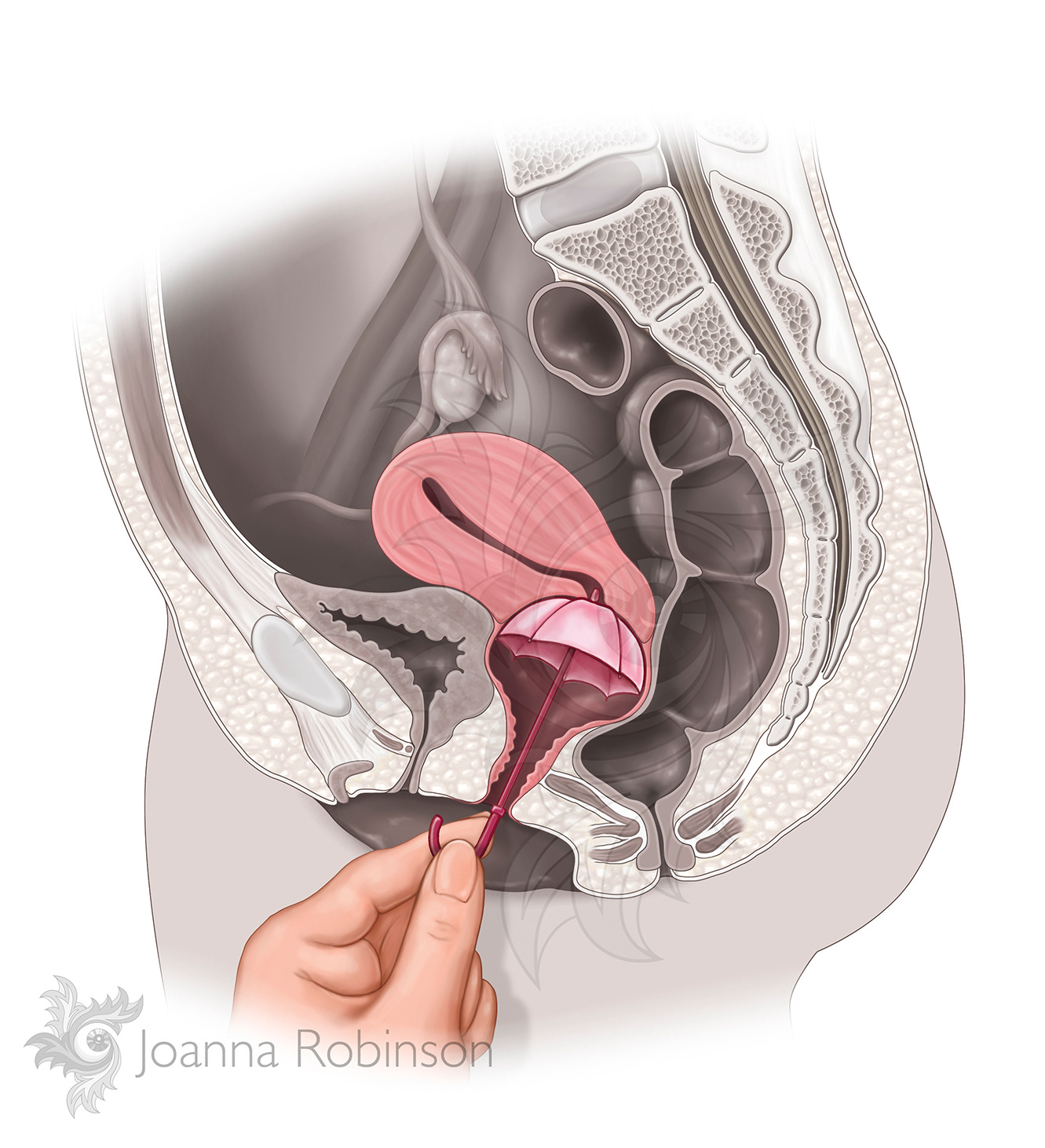 Advertisement illustration. A humorous take on female condoms. Photoshop.