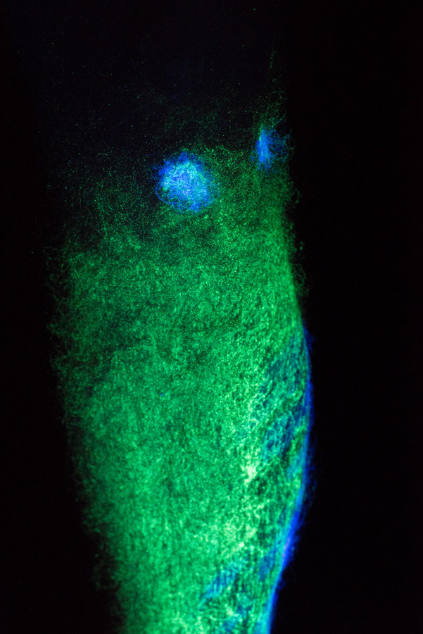 - En quoi ton accident a changé ta vie ? Qu’as-tu appris de cette expérience ? - J’ai appris qui sont mes vrais amis. J’ai appris comment dépasser cela et puis avancer et ne pas laisser quelque chose comme ça t’arrêter de faire des projets. C’est grâce à l’argent que j’ai touché suite à l’accident que j’ai pu venir ici. D’une façon un peu glauque, j’ ai l’impression que ma vie est meilleure maintenant.