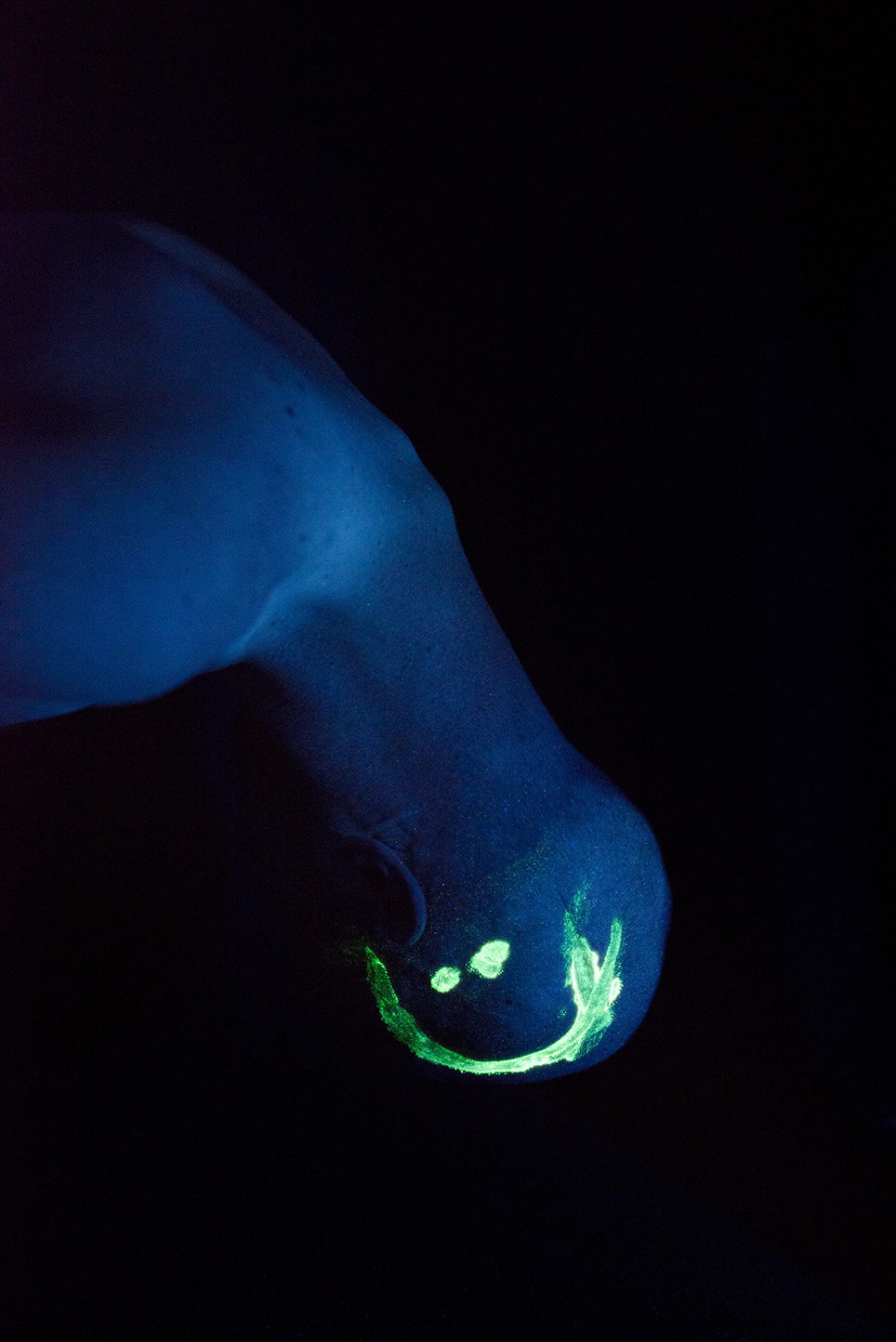 Quand on m’a appris par téléphone que la raison pour laquelle on m’avait hospitalisé d’urgence et ouvert le crâne une dizaine de jours auparavant était un cancer,... J’ai pleuré. J’ai pleuré une dizaine de minutes, abasourdi, soutenu silencieusement par mon compagnon et une amie. J'ai relevé la tête en leur disant : « On s’apitoie et pleure des heures ou on fait de la musique ? »