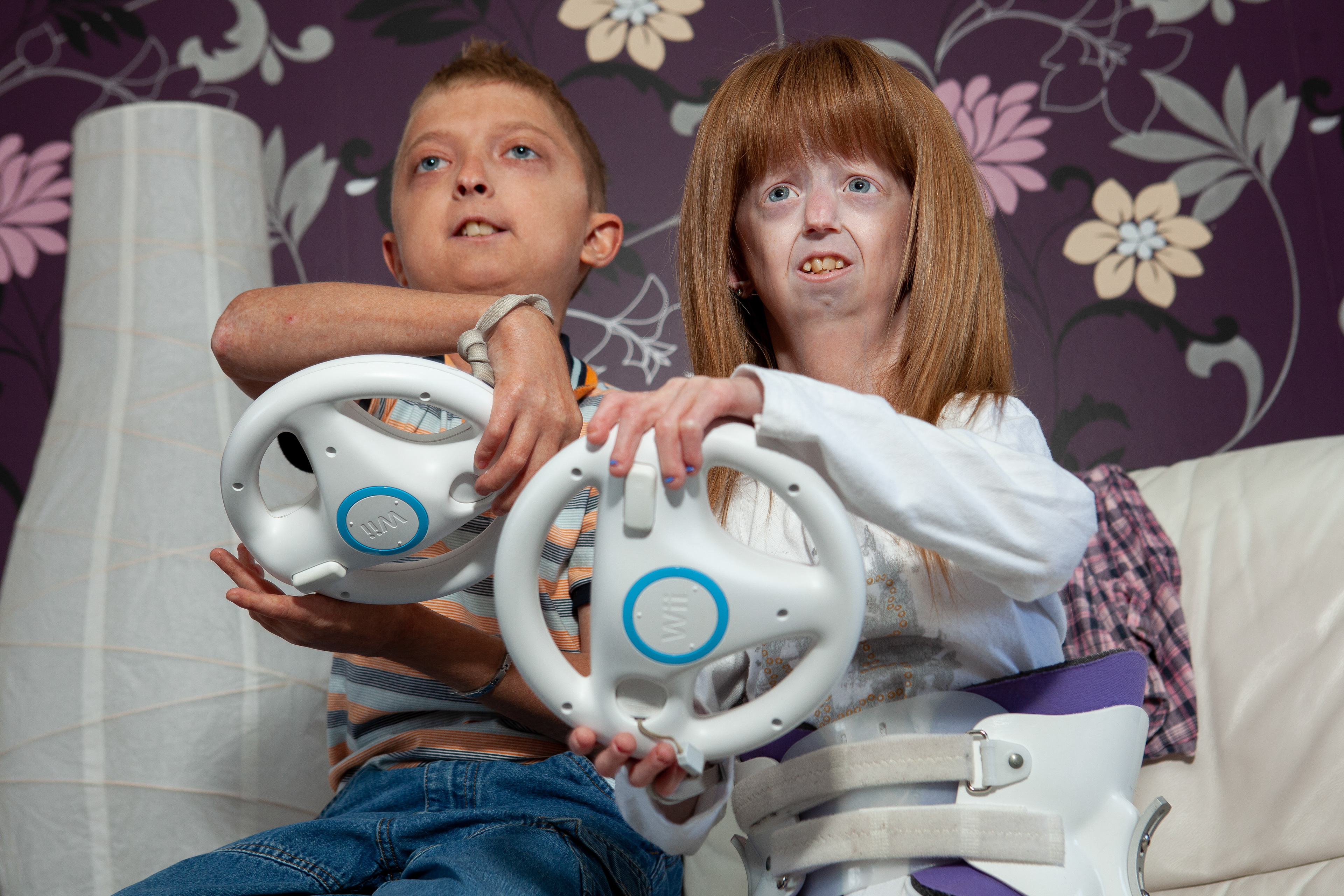 Progeria sufferers playing video games