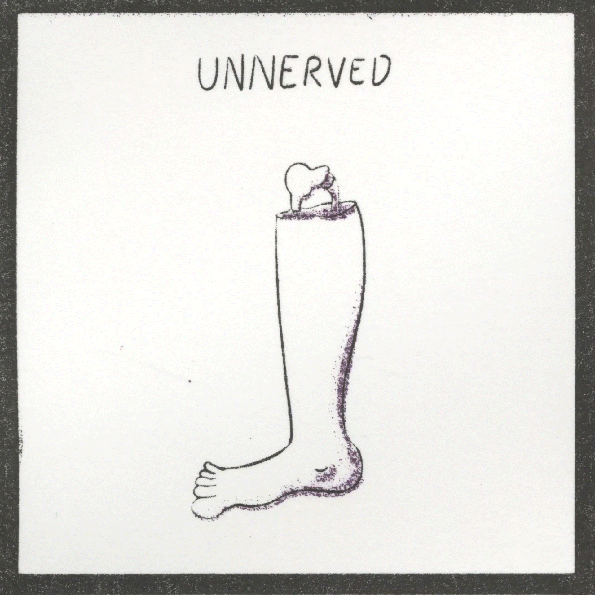 Unnerved Leg