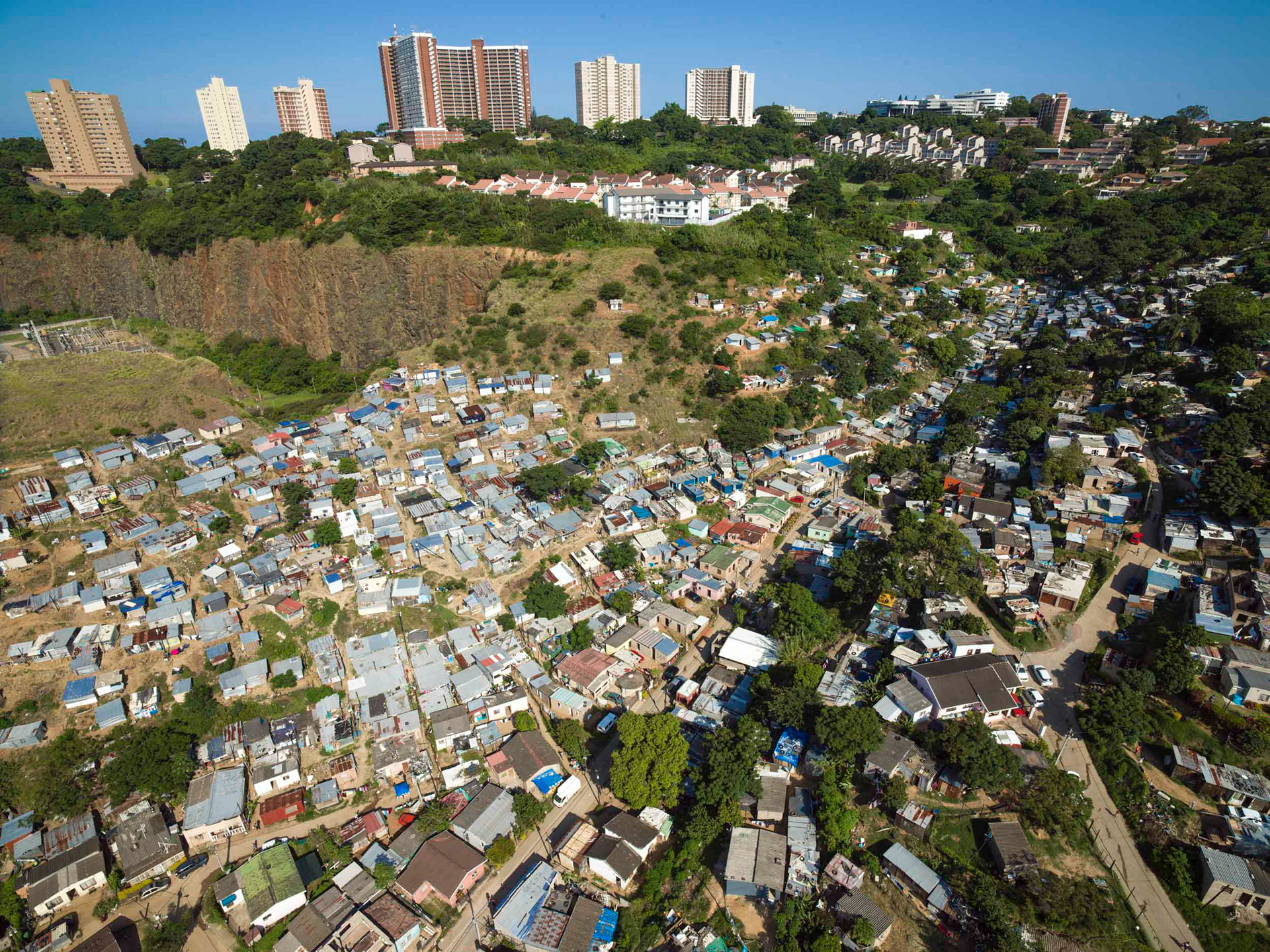 aerial view of shacks and apartment buildings in durban