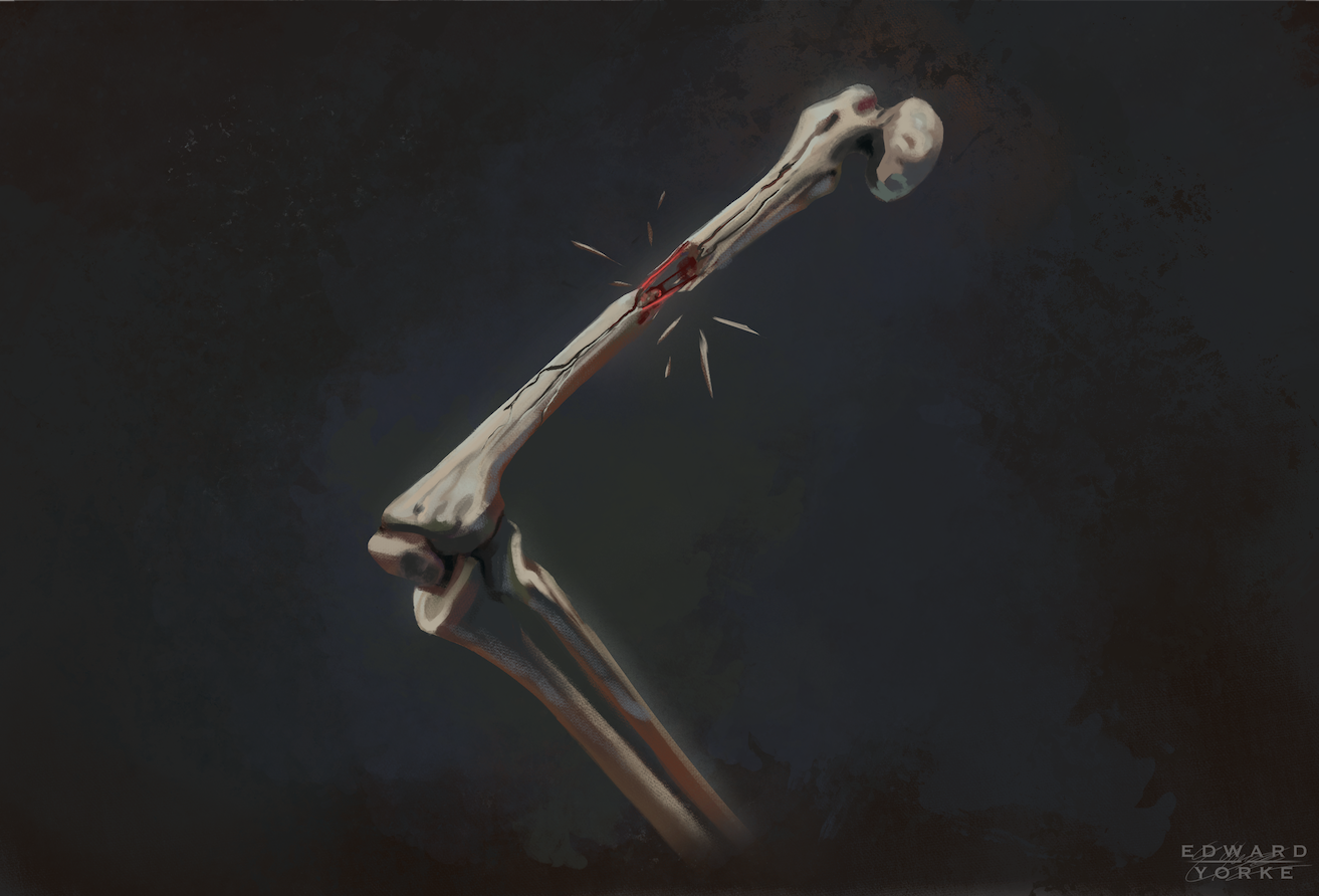 Leg Wound