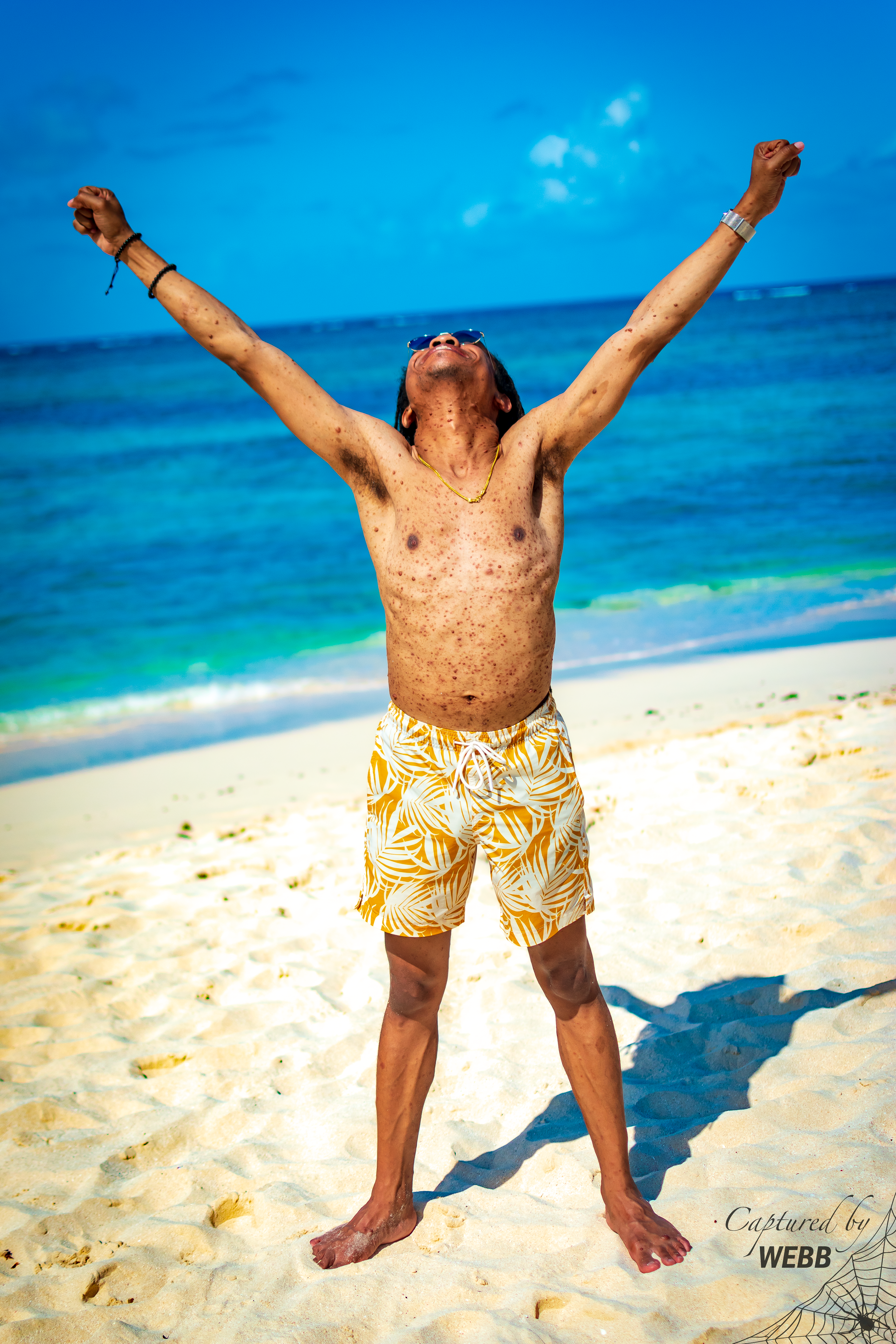 Sun Worshiper - St. Martin