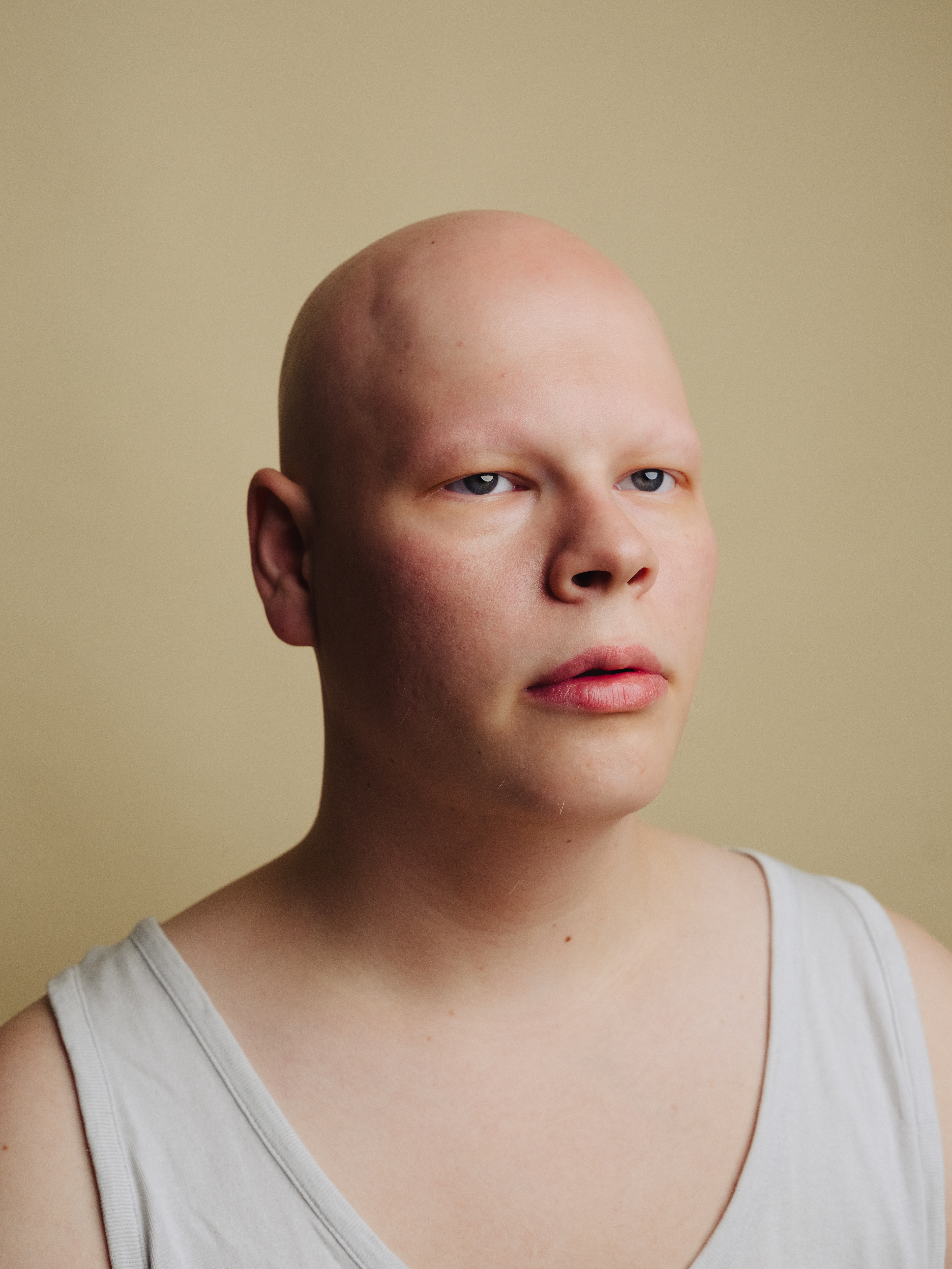 Hannes Tillian