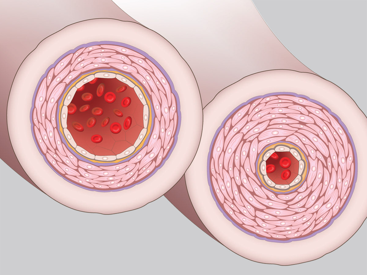 Medical illustration for Driscoll Bell, LLC