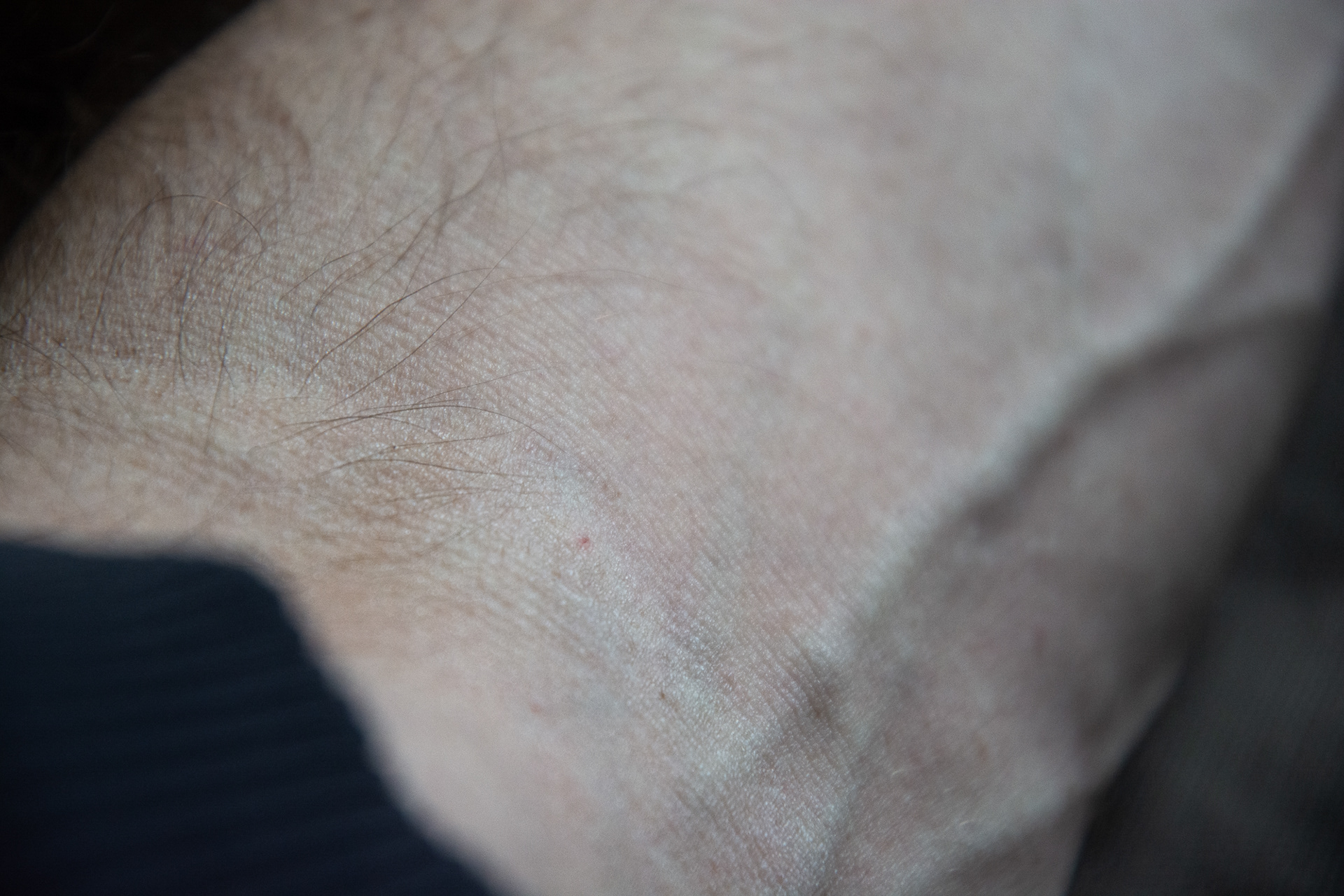 50/365 Blood test