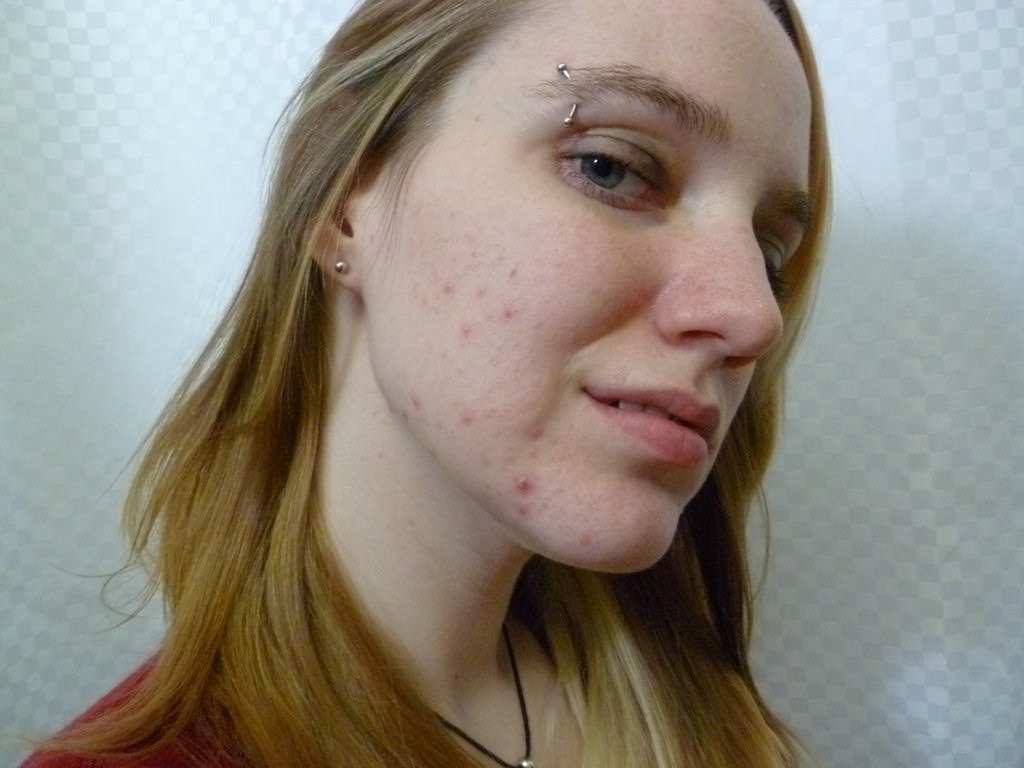 Before